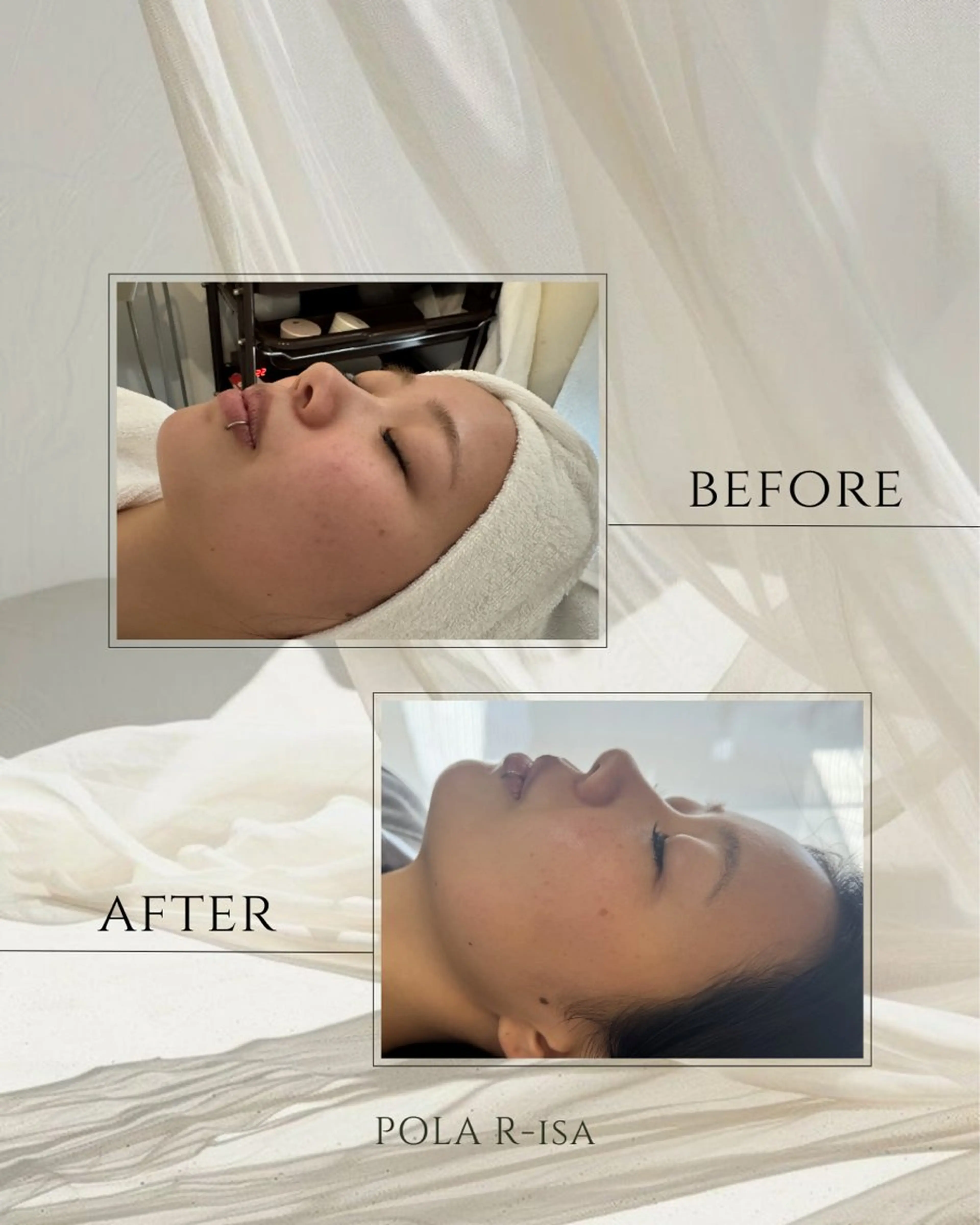 POLA Ｒ－ｉｓａ 南船場店所属・韓国肌/ピーリング POLA꒱AIのエステ・リラクイメージ