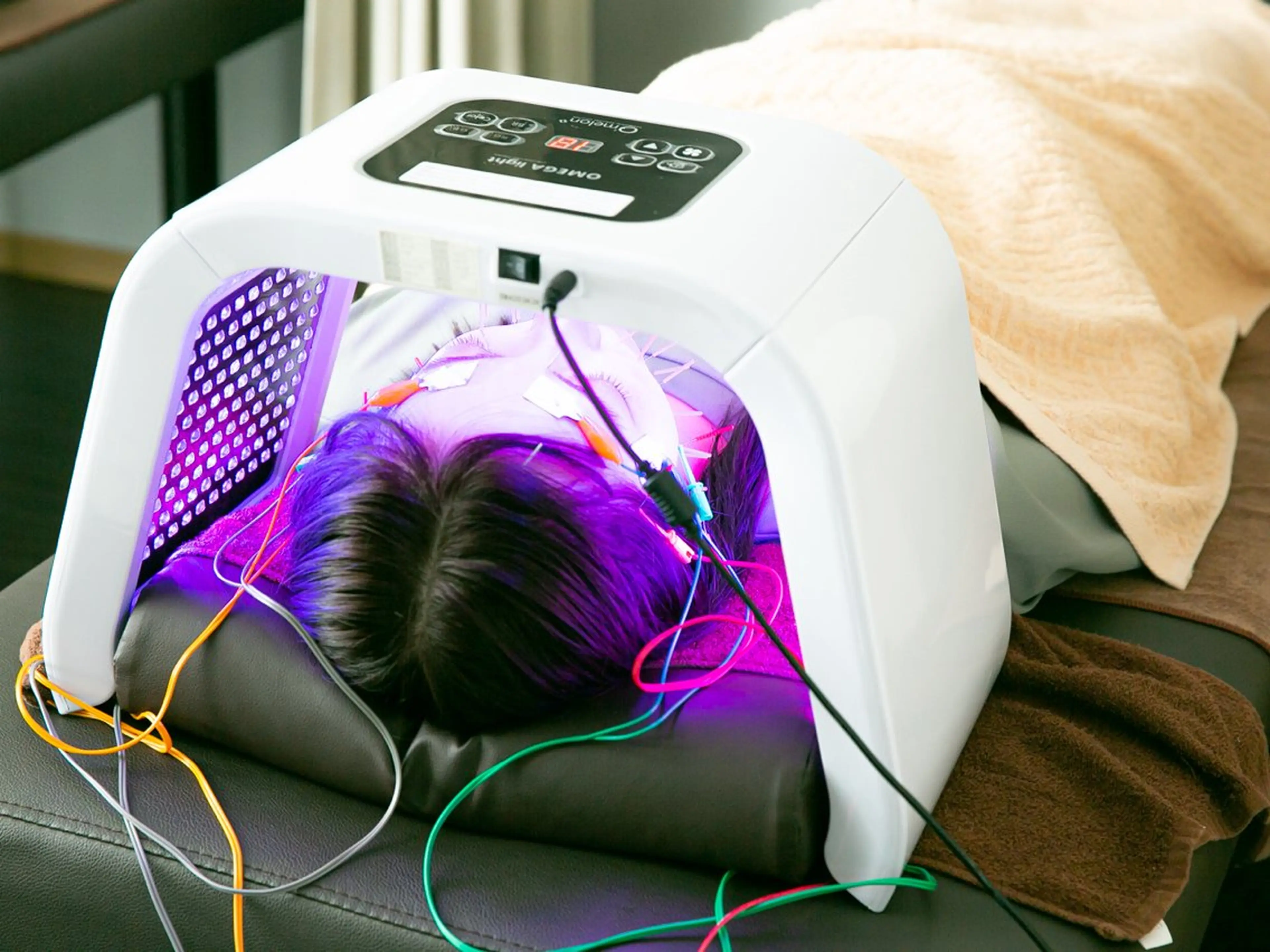 初回割✨【横川式】本格美容鍼＋電気パルスの写真