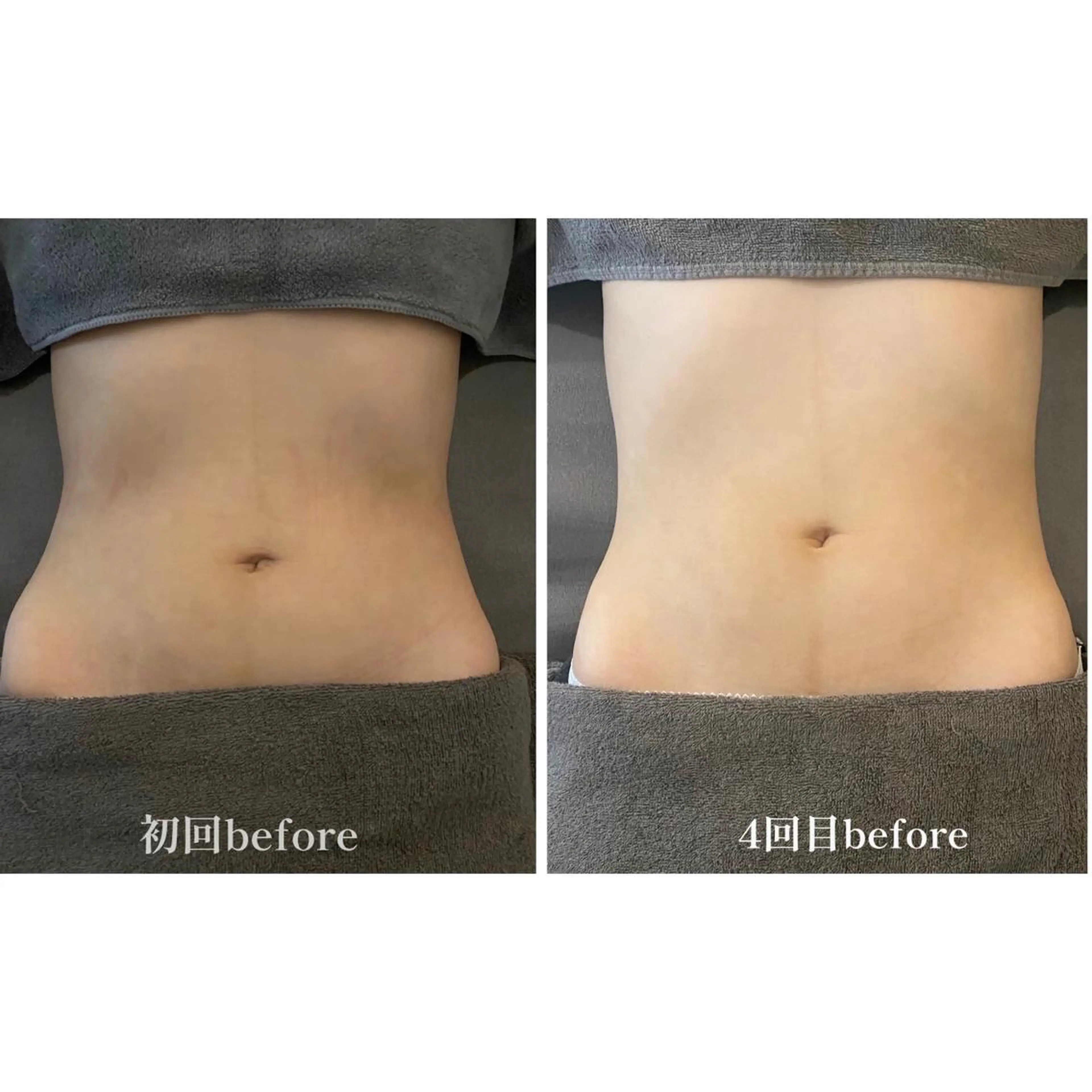 人気No.1【体質改善】東洋式内蔵セラピー+背中or脚全体リンパマッサージ80分の写真