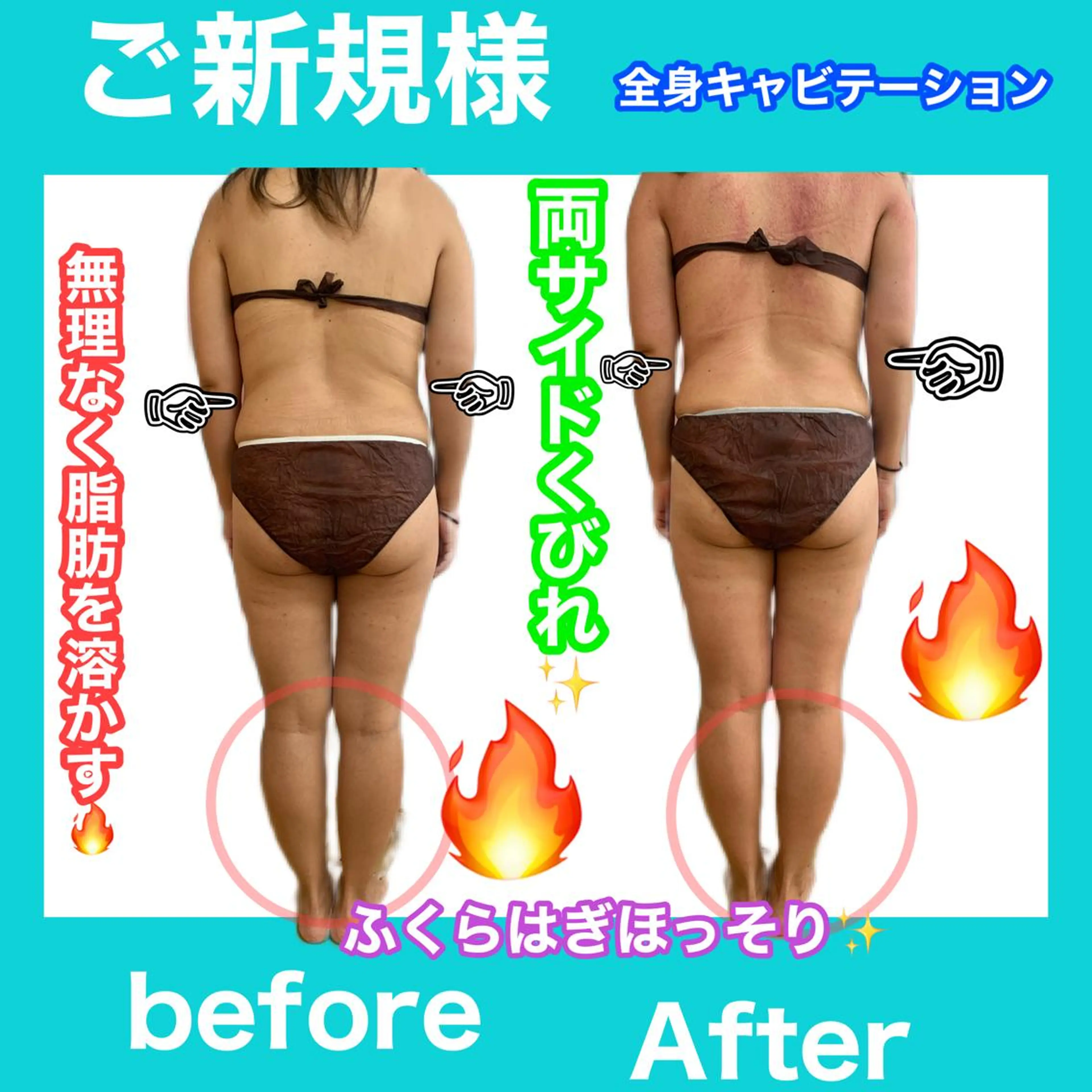 エステ リラク 痩身/脱毛/ネイル HARUKAのエステ・リラクイメージ