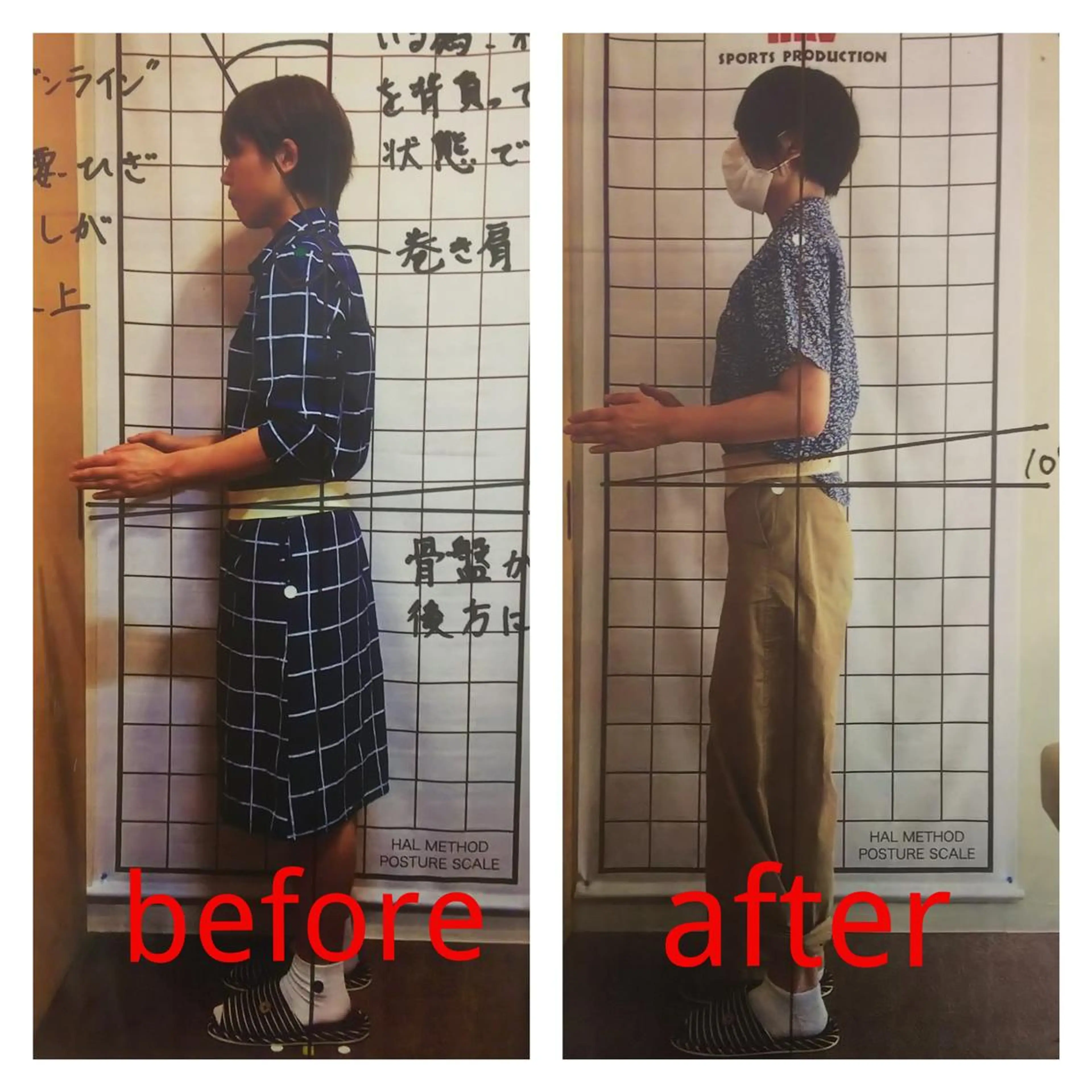 リフトアップ・たるみ ☆美容鍼小顔矯正のその他イメージ