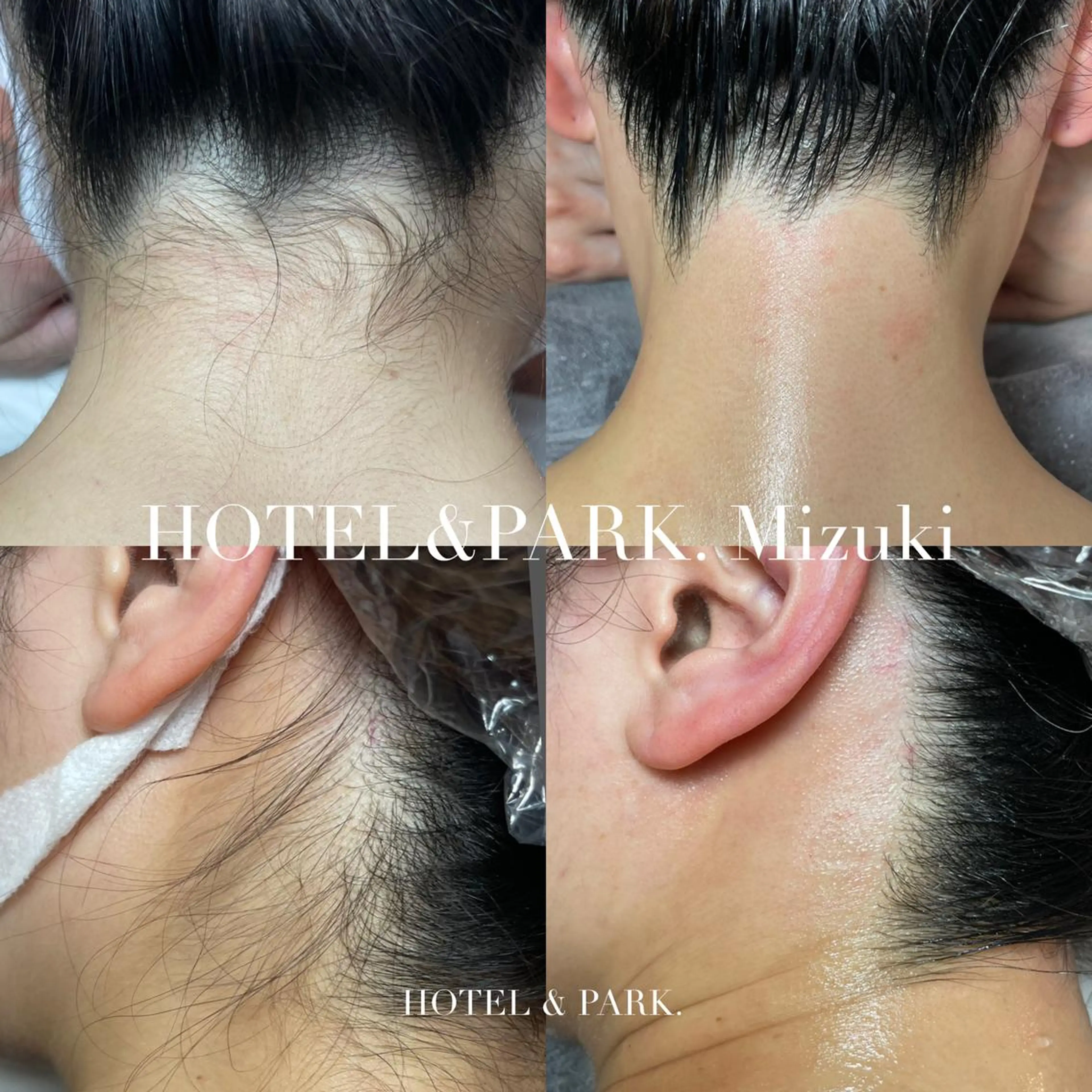 HOTEL&PARK . ワックス脱毛のエステ・リラクイメージ