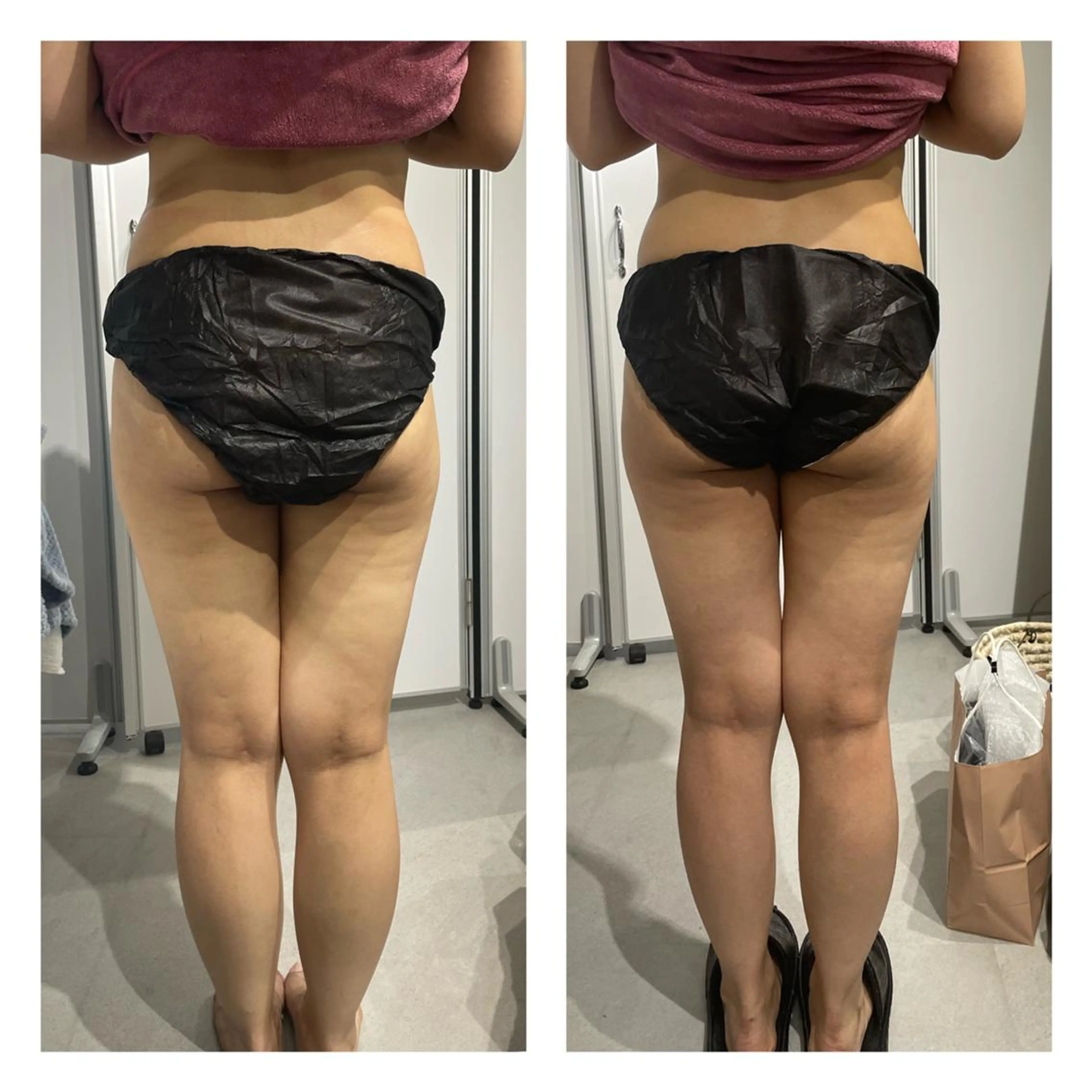 エステ リラク 部分痩せ♥️小顔専門 MIKUのエステ・リラクイメージ