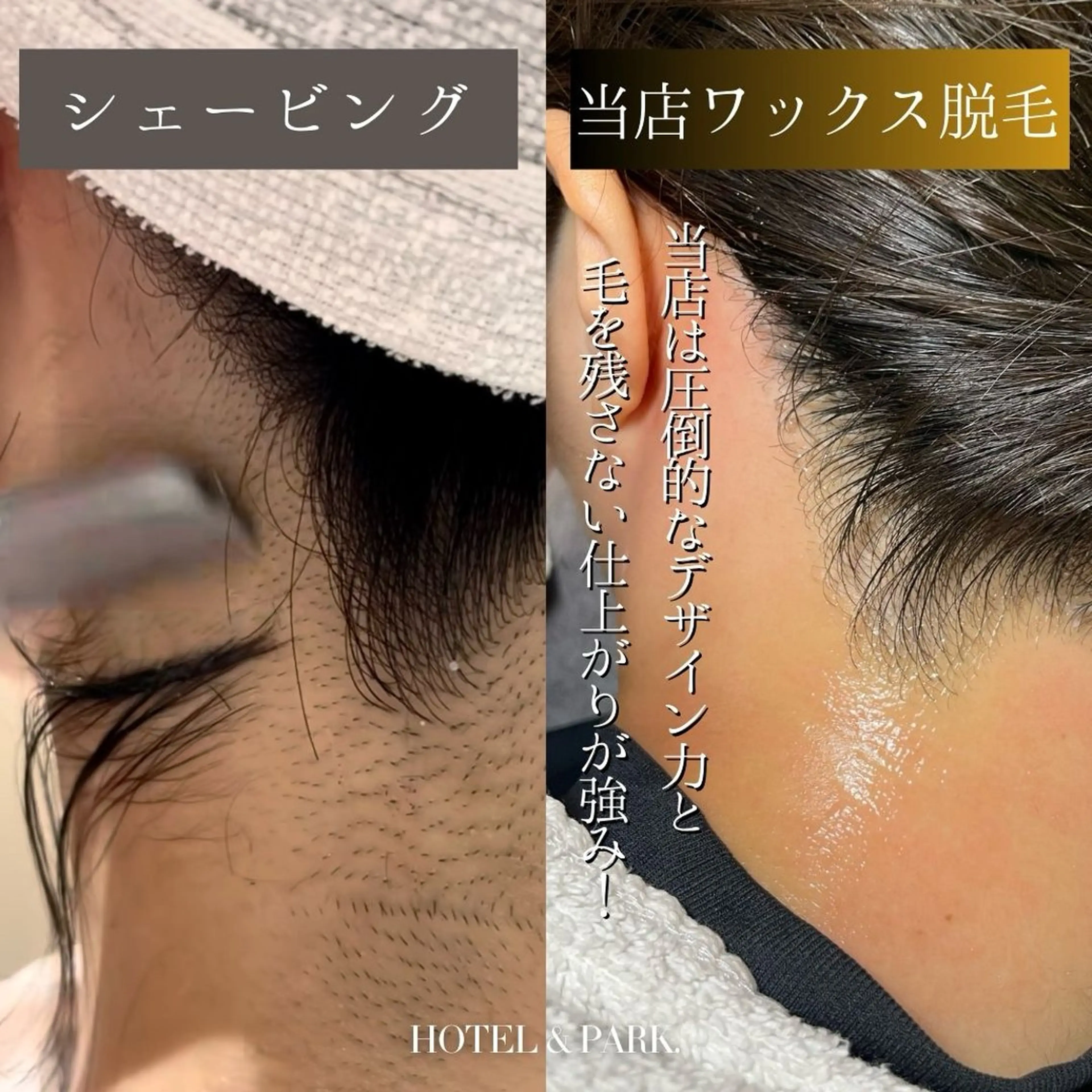 HOTEL&PARK . ワックス脱毛のエステ・リラクイメージ