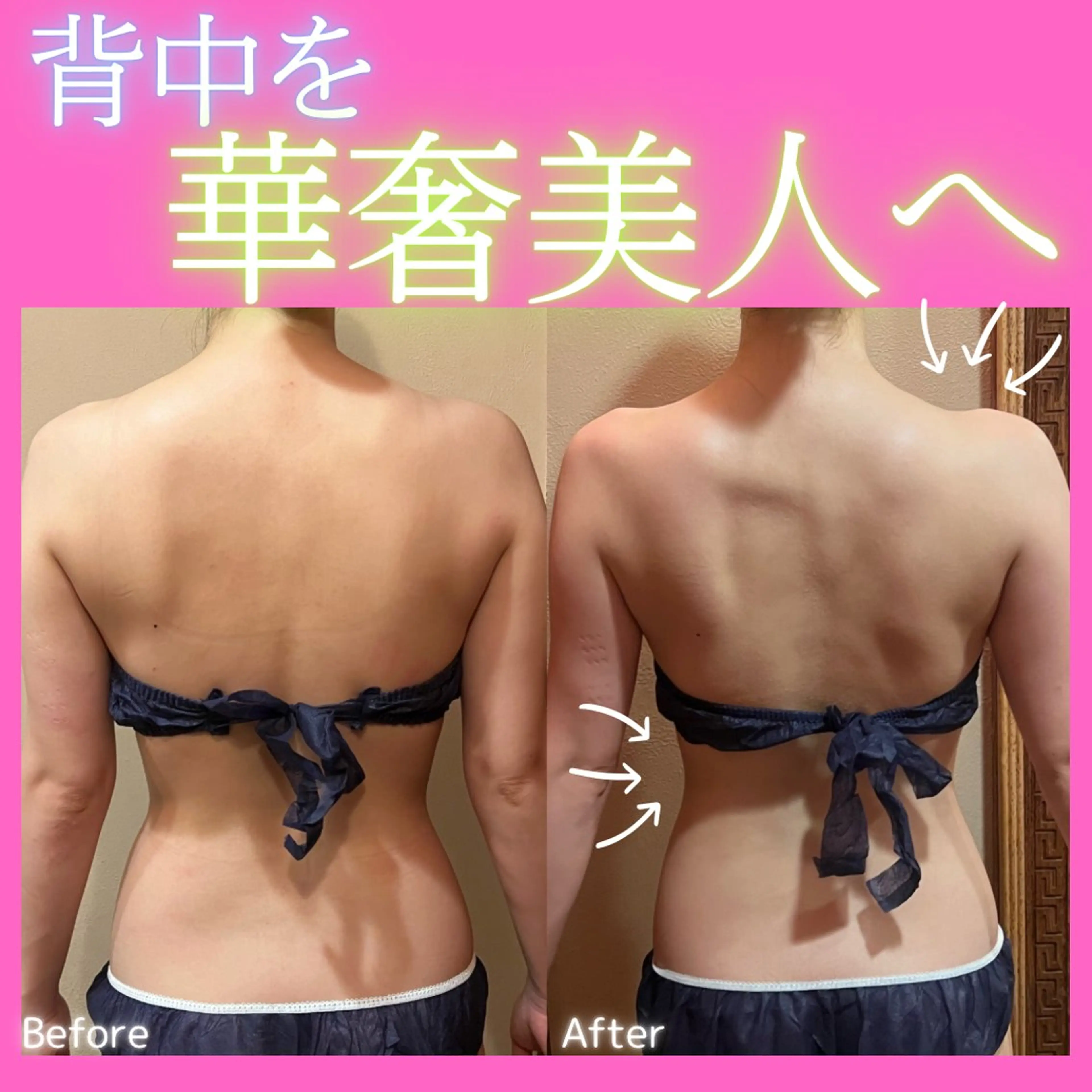 エステ 痩身&美肌サロン 堀米✨のその他イメージ