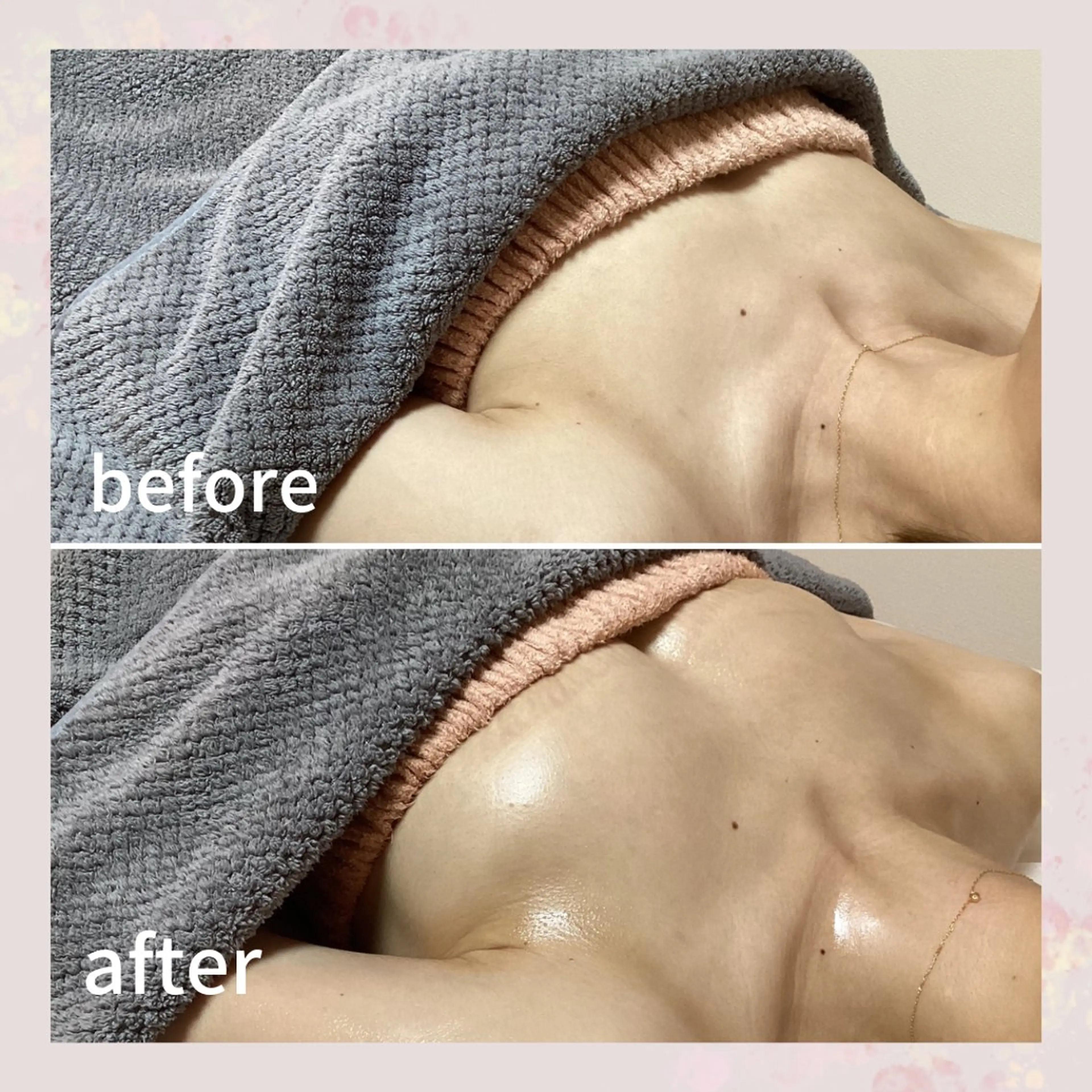 産後バスト🥲バスト復活特別メニュー✨産後のデコルテ削げ、下垂でお悩みの方へ😌産後バストに特化した施術メニュー🎉の写真