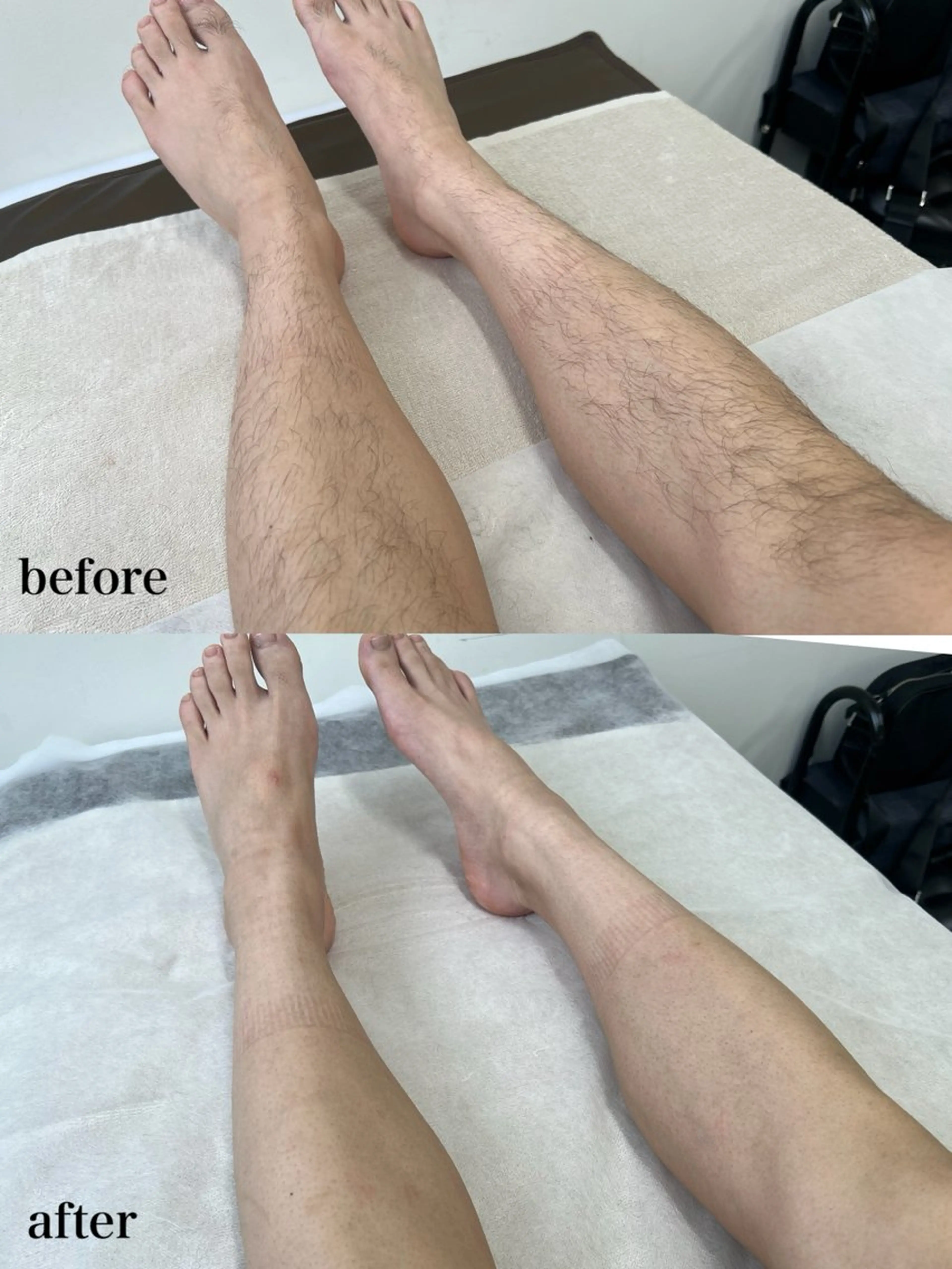 メンズ 脱毛 瀬戸 梨子のエステ・リラクイメージ