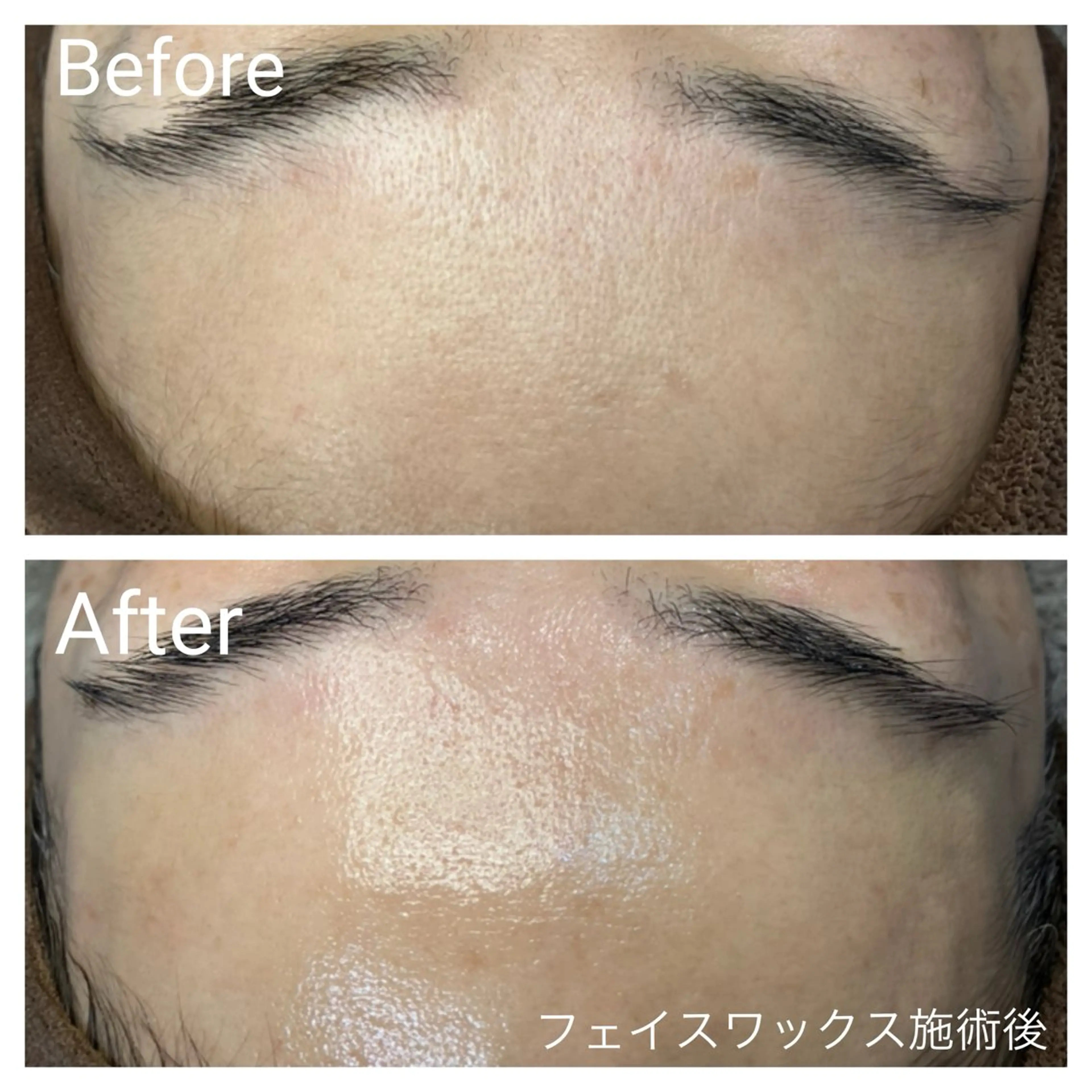 【ざらつき・艶肌・産毛に⭐️】艶肌フェイスワックス(全顔)80分の写真