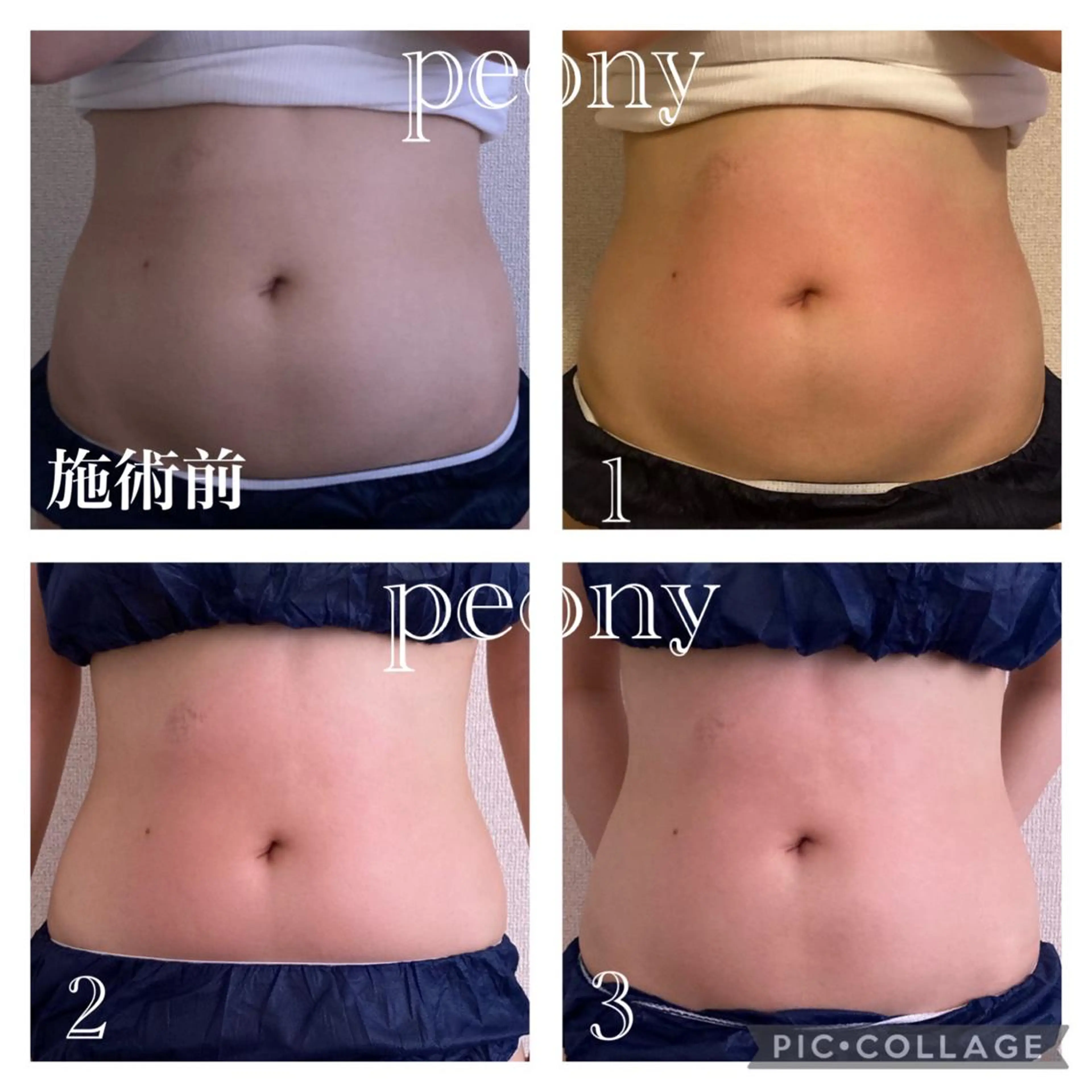 デトックス美容専門サロンｐｅｏｎｙ所属・デトックス美容専門 サロンｐｅｏｎｙのエステ・リラクイメージ