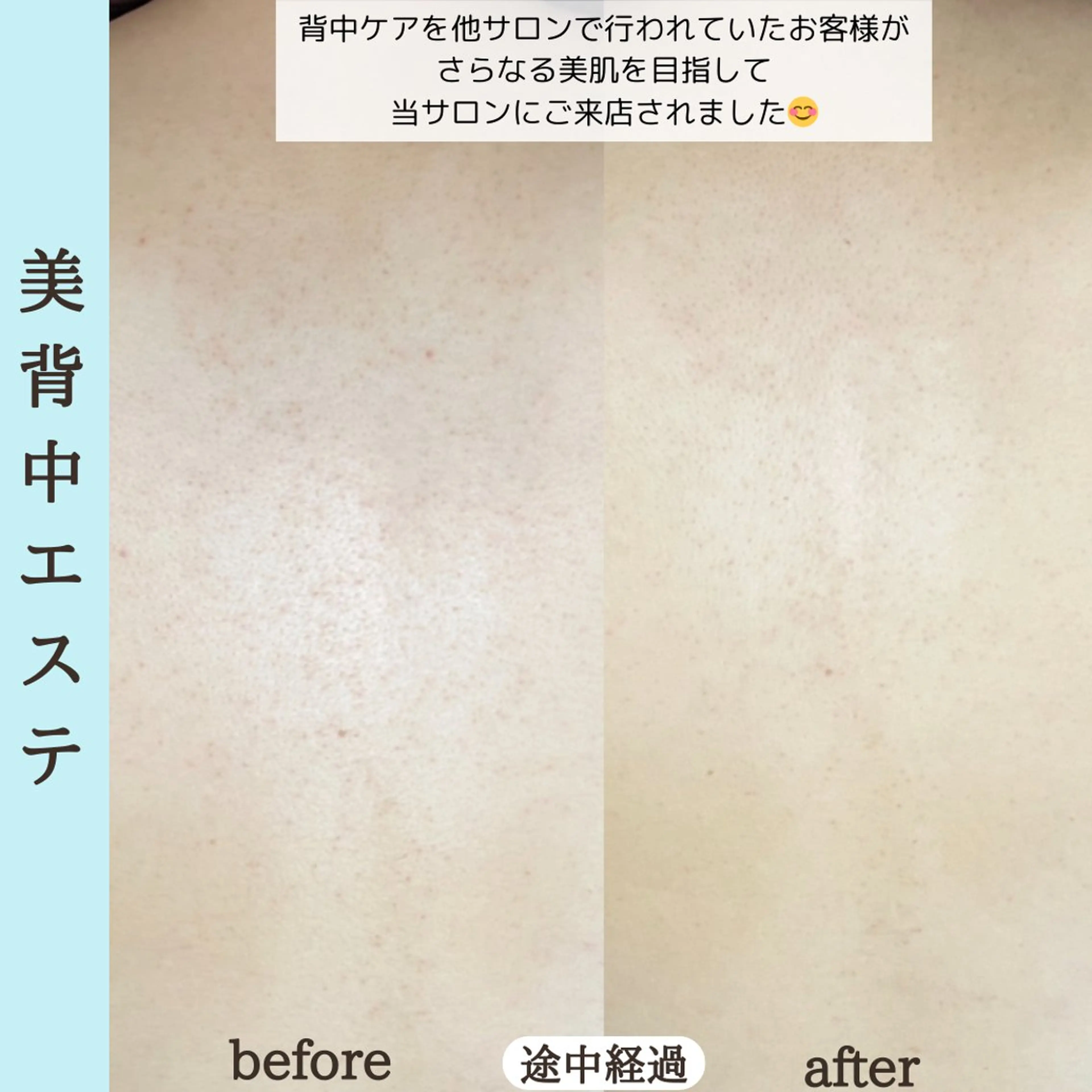 エステ ベラージュ【美背中・ 美尻・フェイシャル】のエステ・リラクイメージ