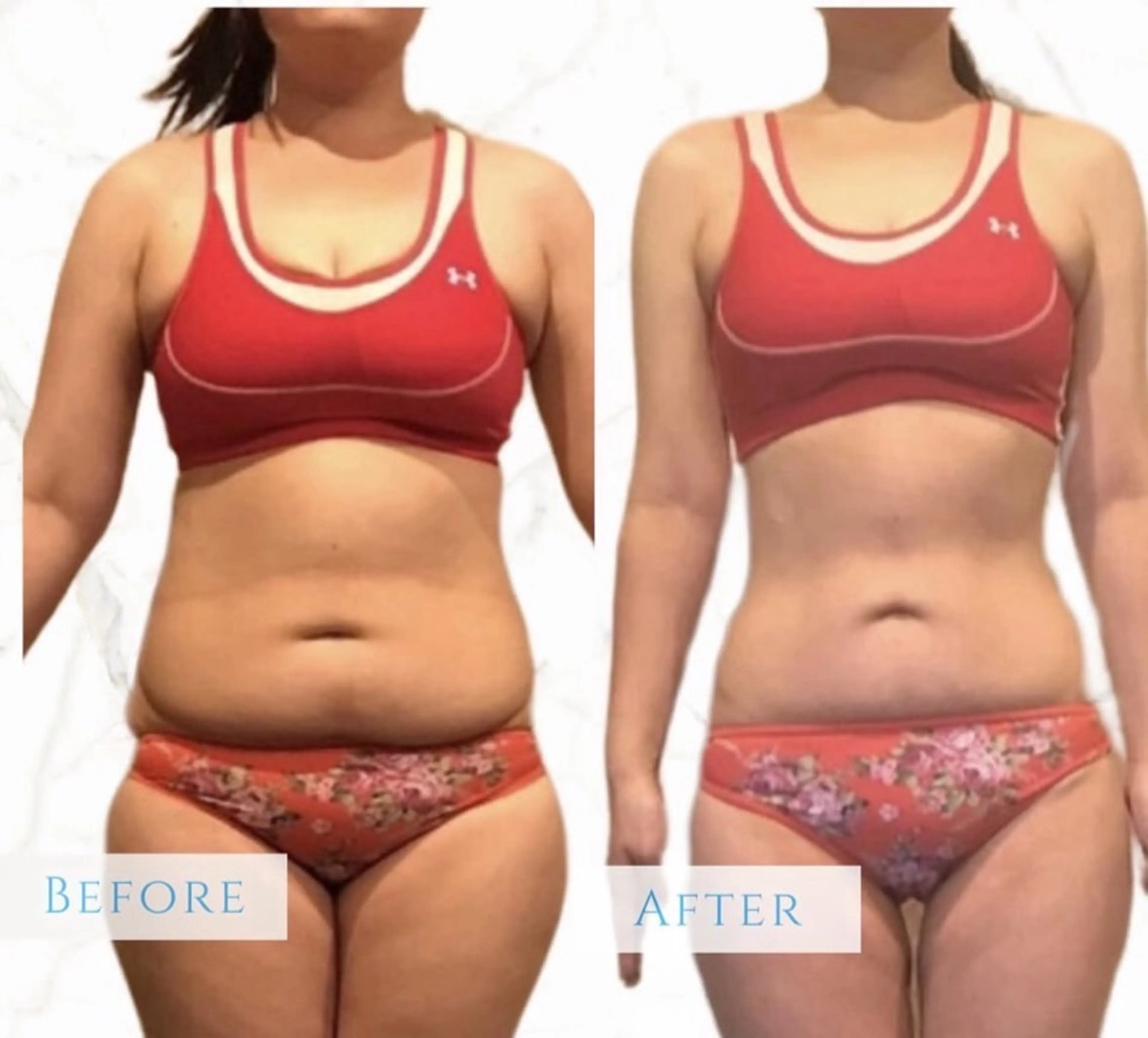 レセラ銀座所属・レセラ 銀座のエステ・リラクイメージ