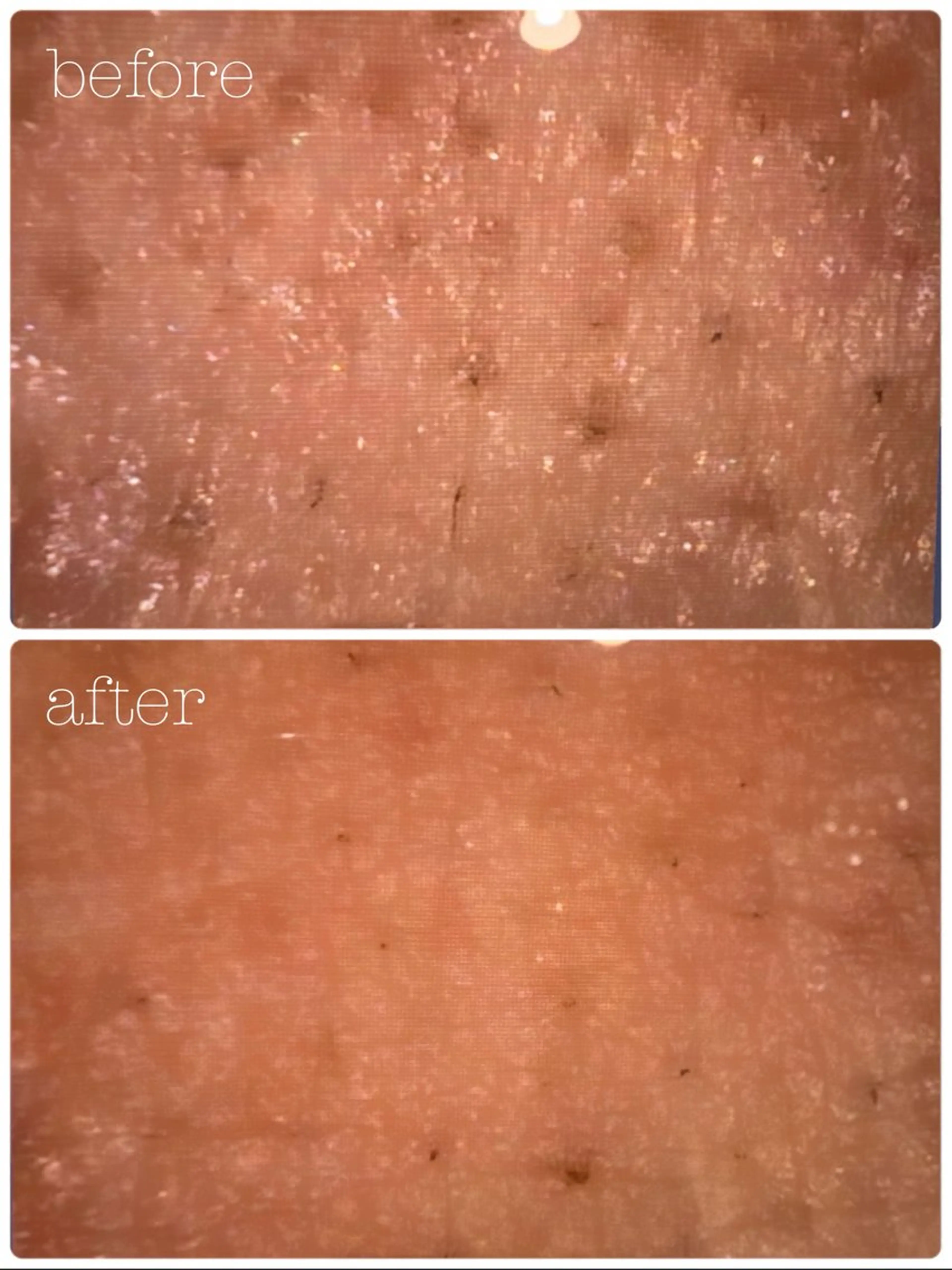 POLA THE BEAUTY 堺東店所属・肌管理🌿毛穴改善 POLA堺東のエステ・リラクイメージ