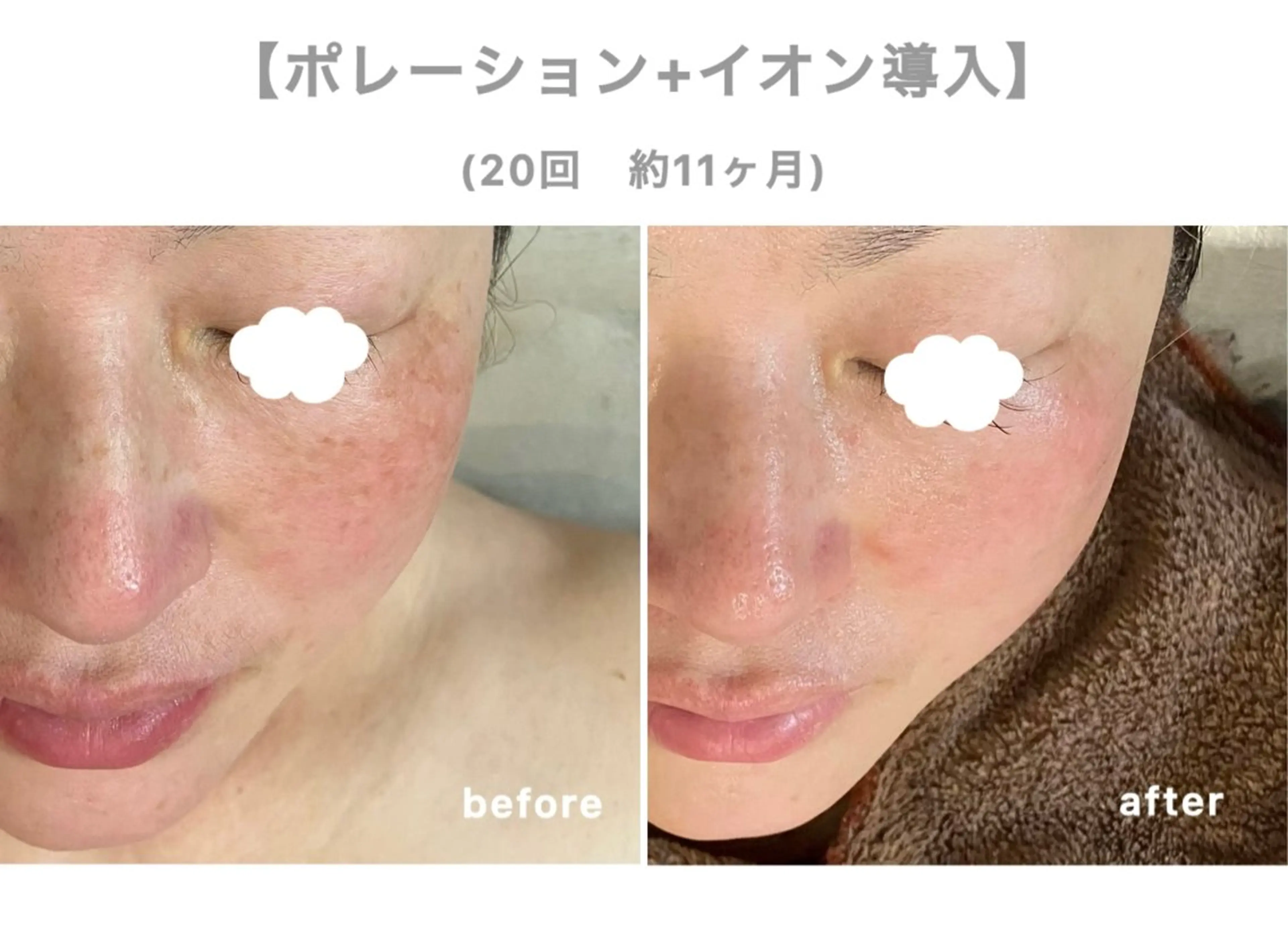 【Folche 春日店】馬場・大内田のエステ・リラクイメージ