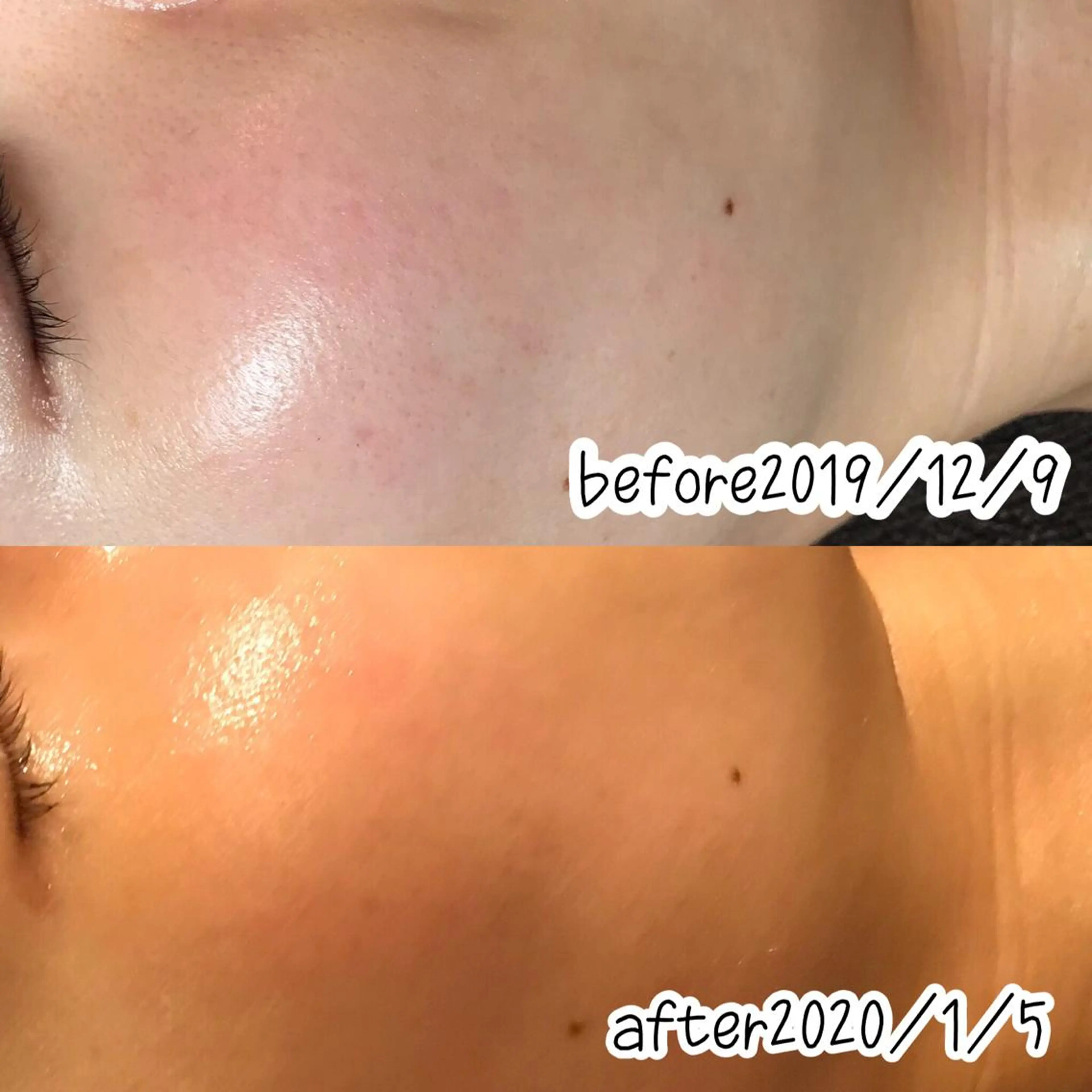 エステ 浜野 恵美のエステ・リラクイメージ