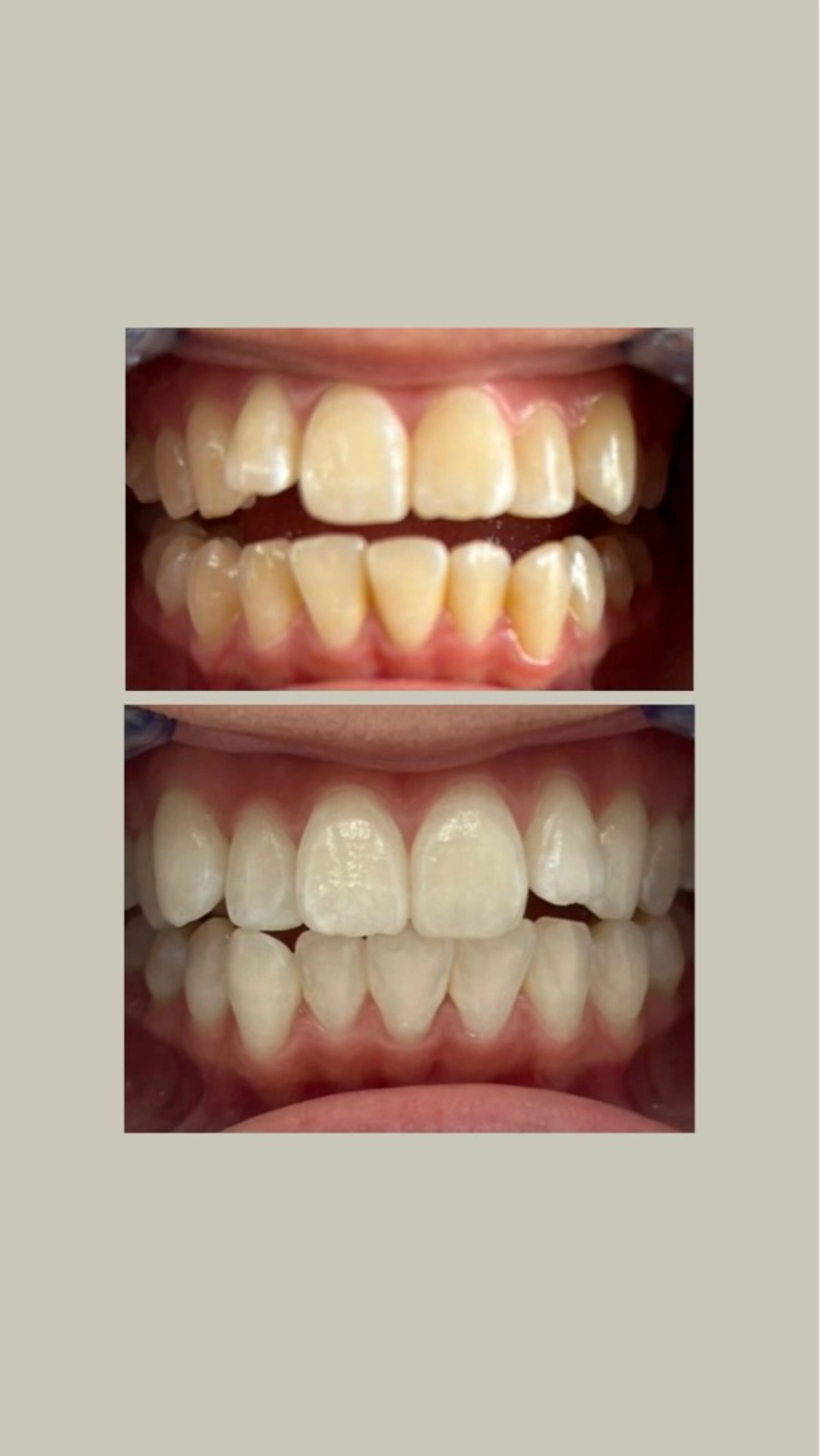 エステ セルフホワイトニングサロンエクシアホワイト倉敷店所属・ecxiawhite 倉敷店のエステ・リラクイメージ