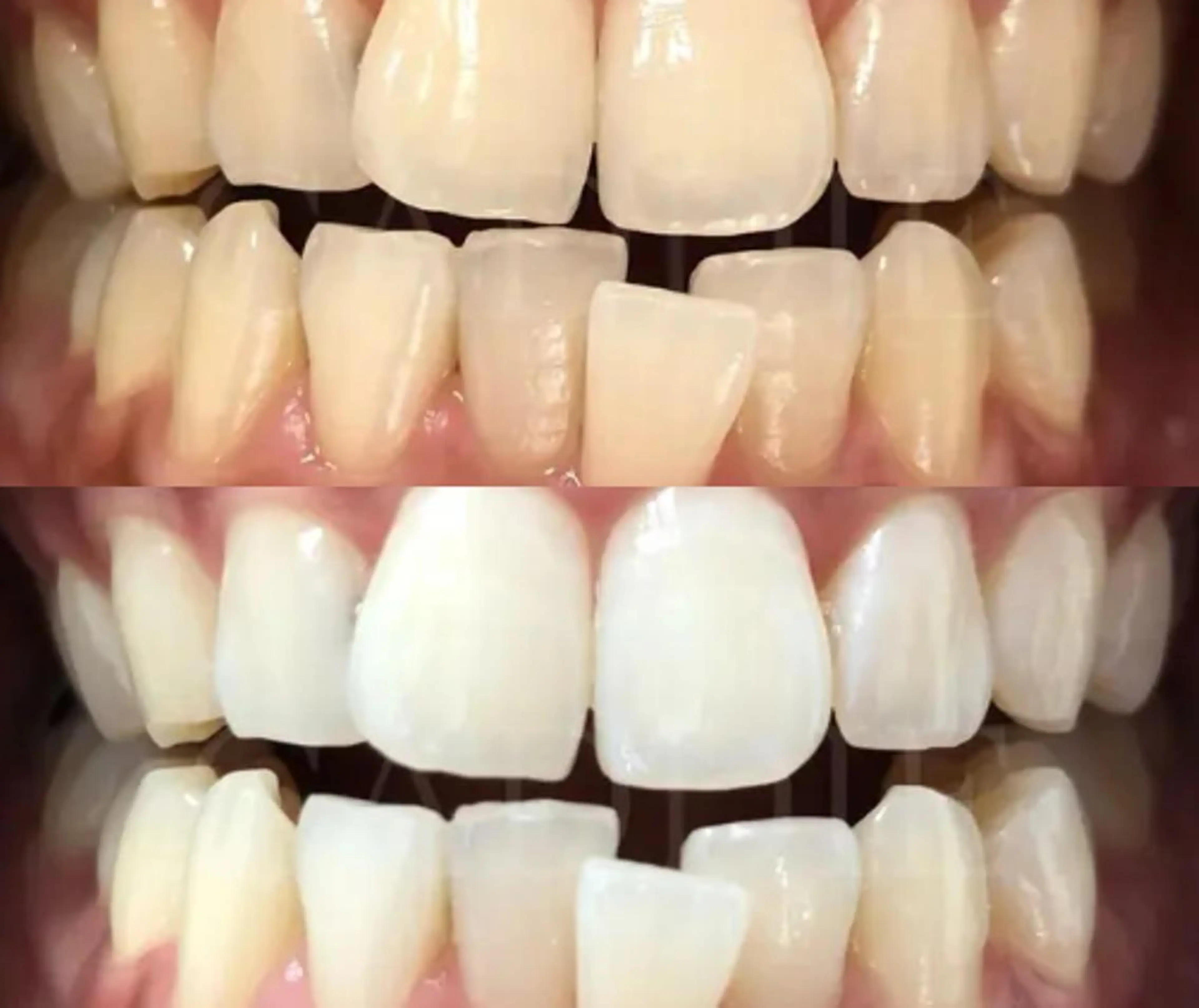 その他 ライトケアサロン 表参道店① 佐々木のその他イメージ