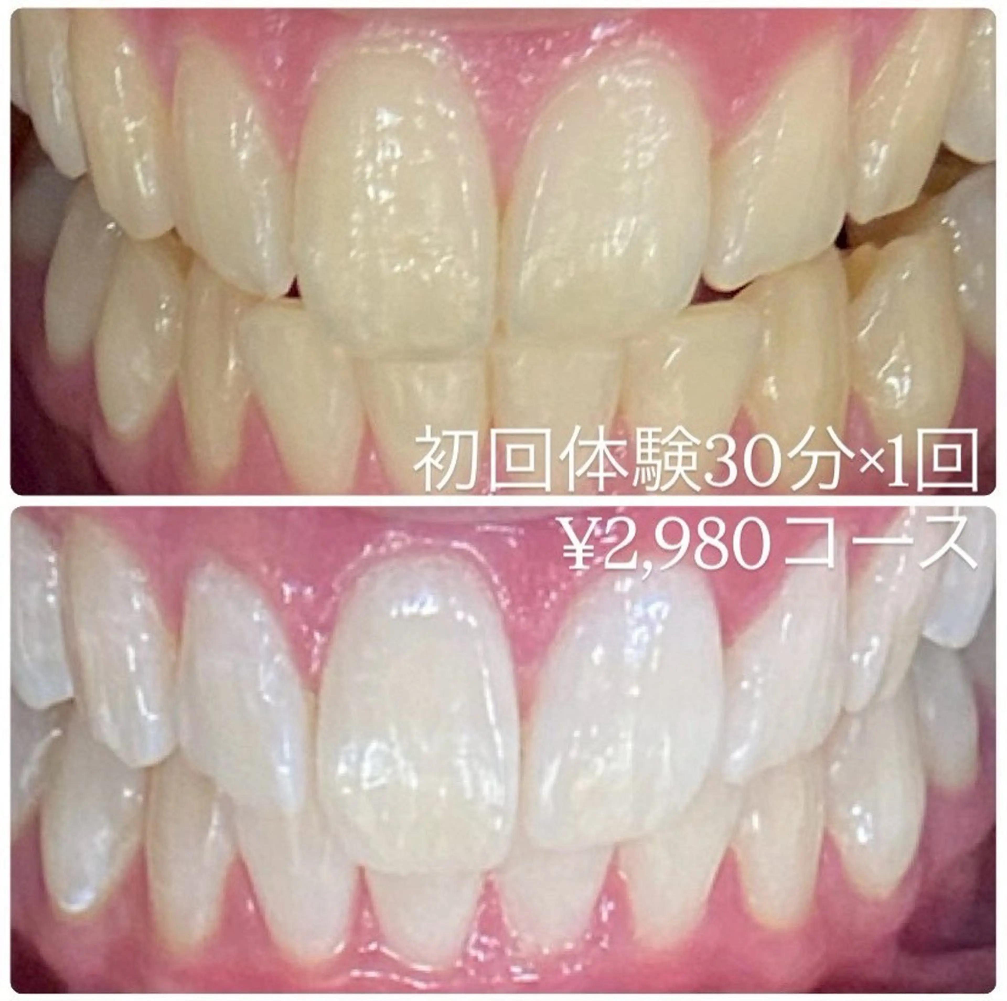 メンズ その他 ホワイトニングルーム　川崎店所属・ホワイトニング ルーム　川崎店のその他イメージ