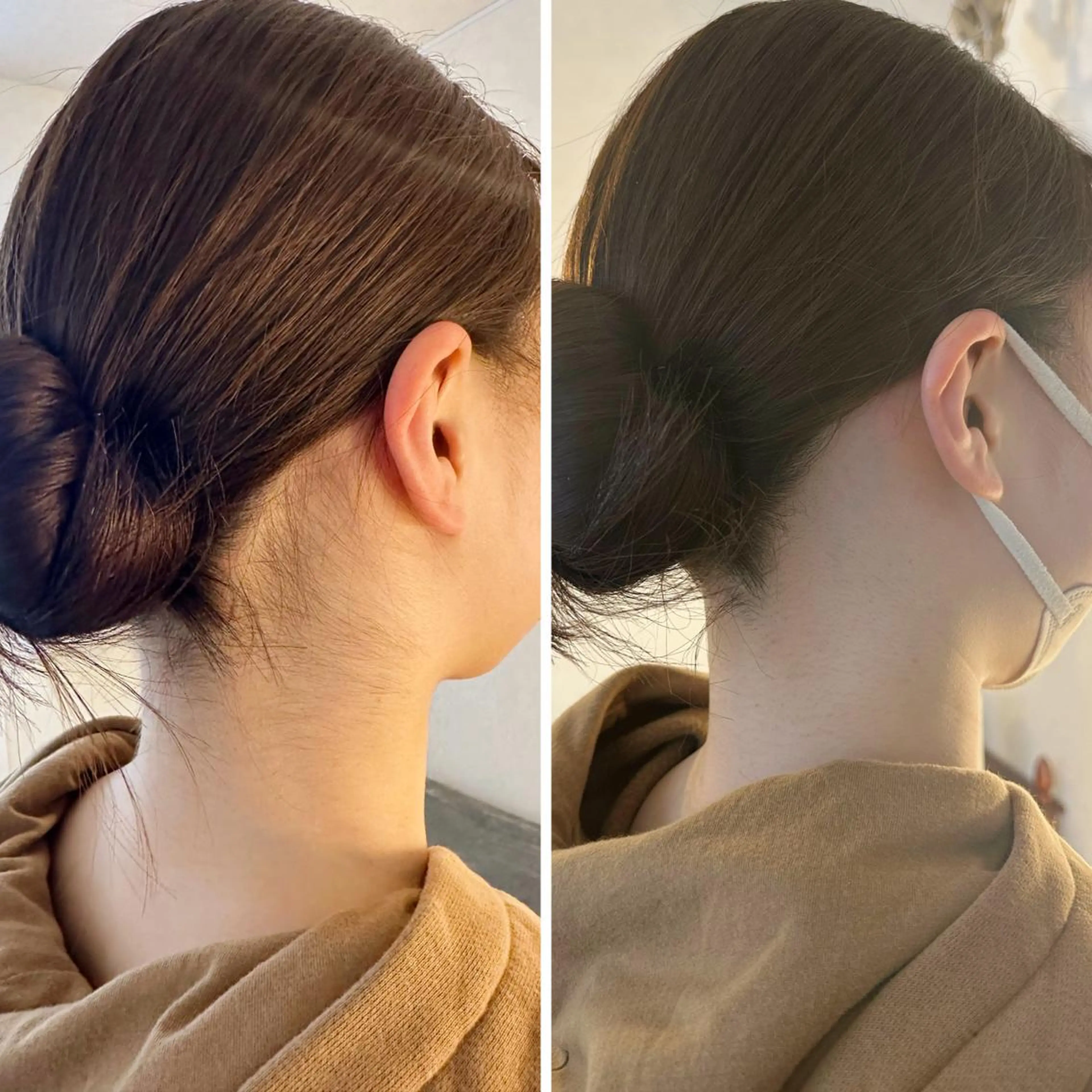 うなじ脱毛/美肌脱毛 LABELのエステ・リラクイメージ