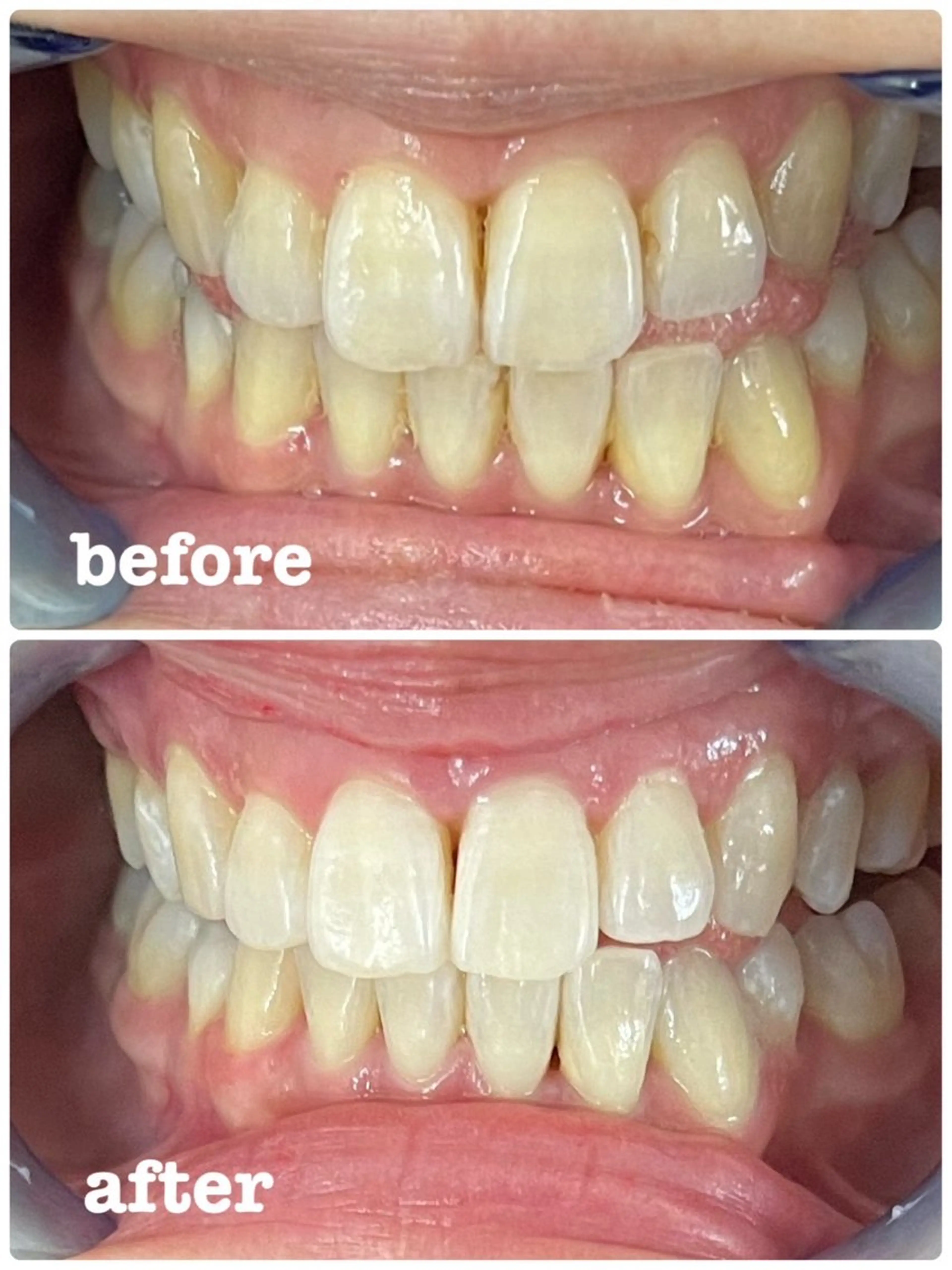 セルフホワイトニング エクシア徳島店マユのその他イメージ