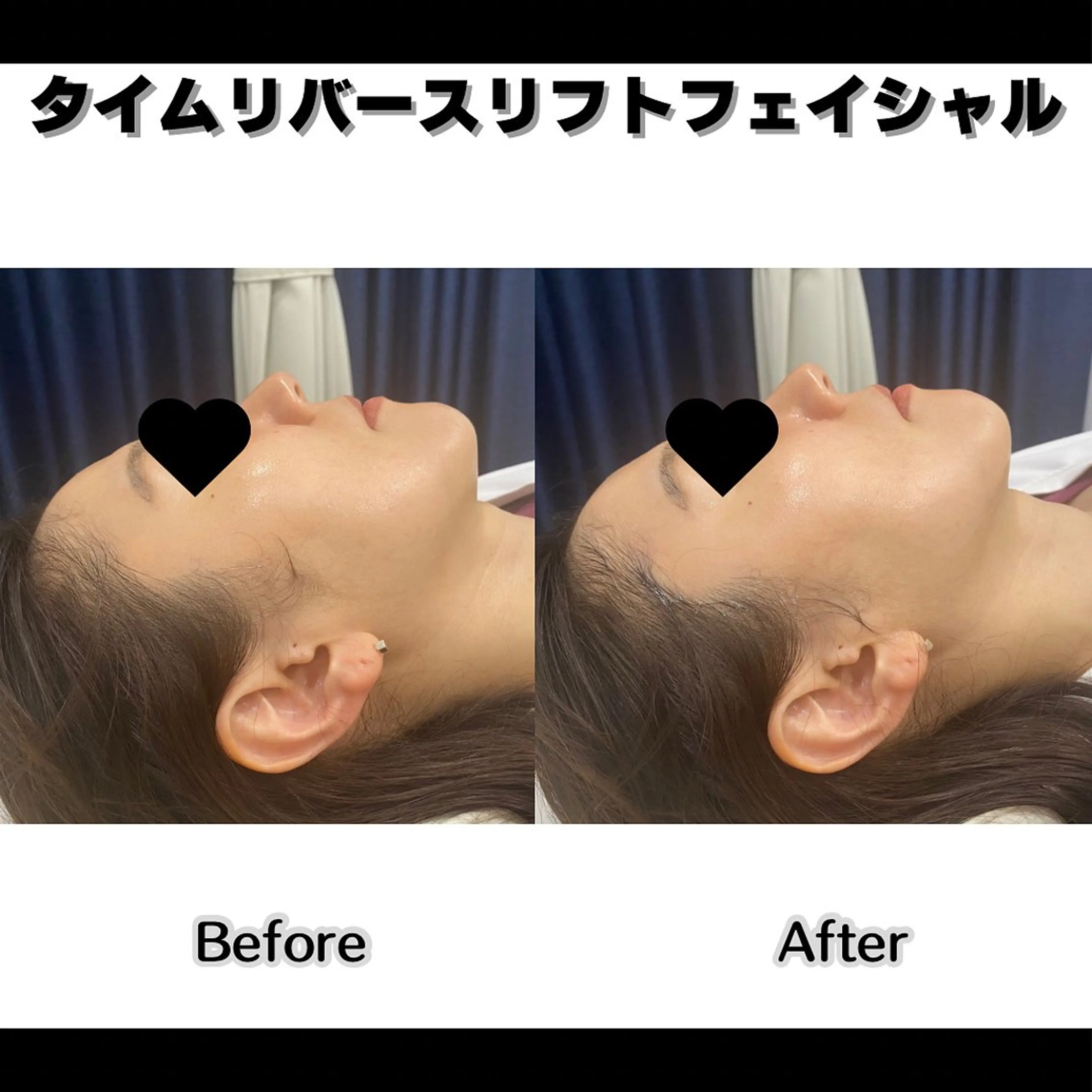 エステ Clear Canvasのエステ・リラクイメージ