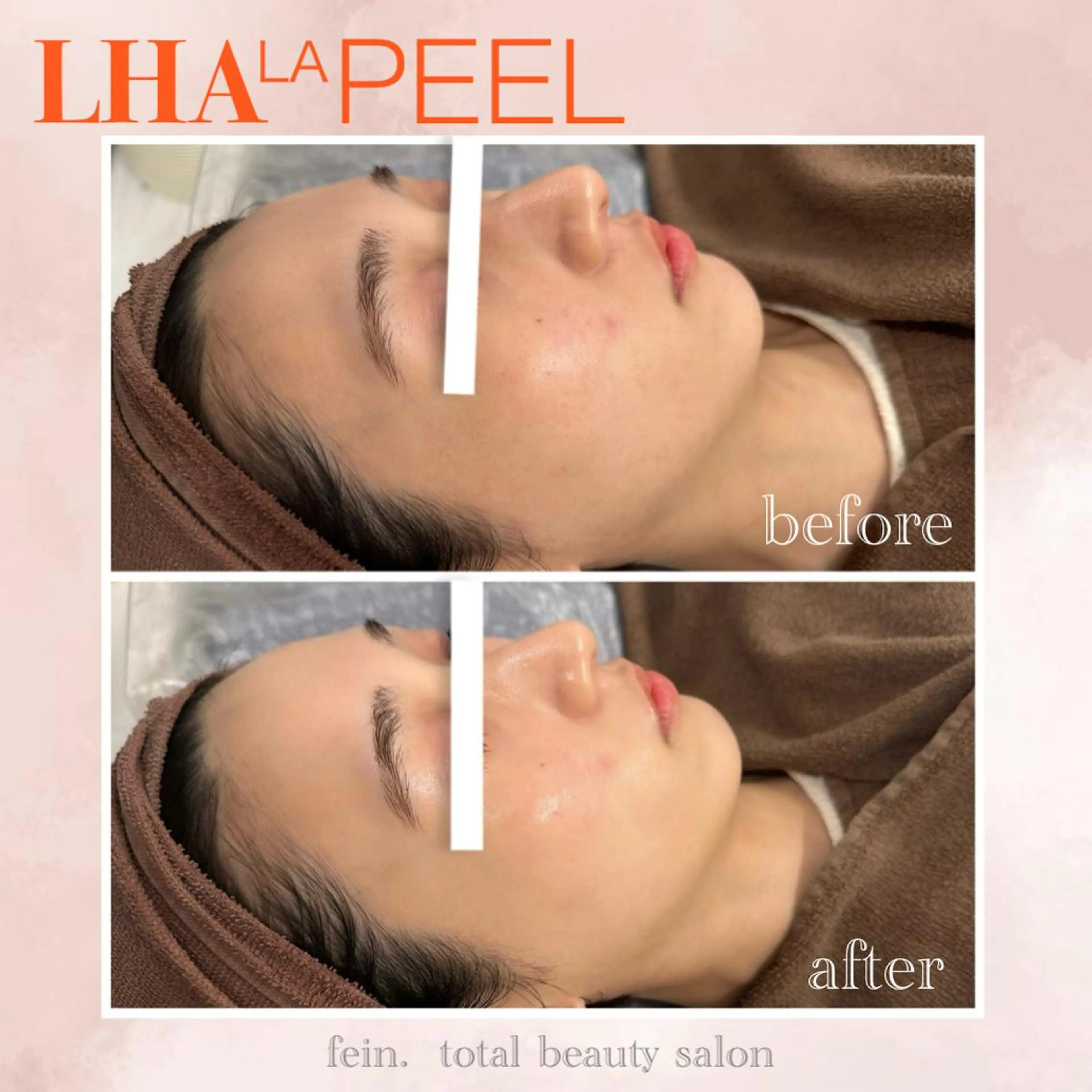 エステ 🌈fein.トータ ルビューティー🌈のマツエク・マツパデザイン