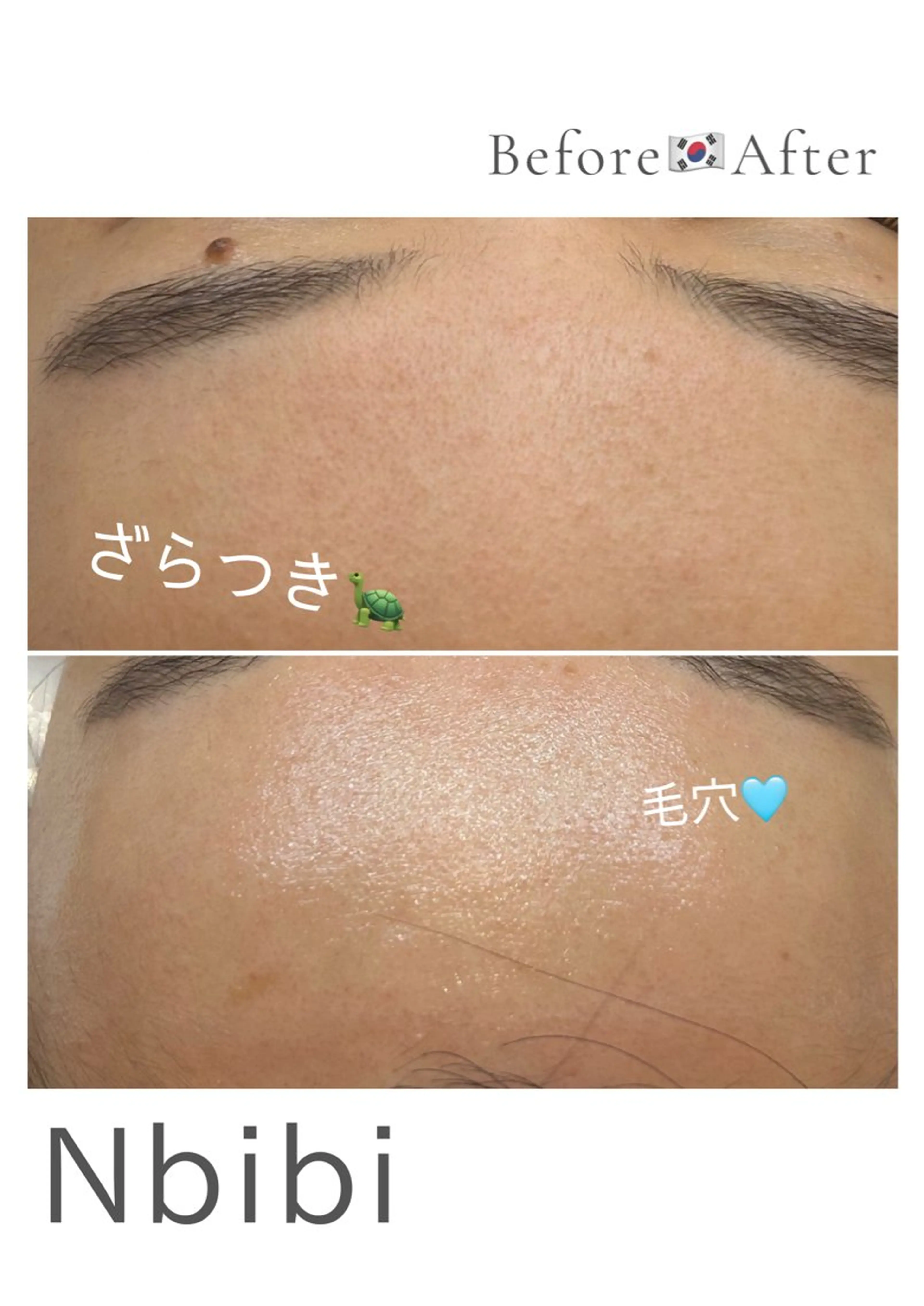 エステ 韓国🇰🇷価格 サロン_Nbibiのエステ・リラクイメージ