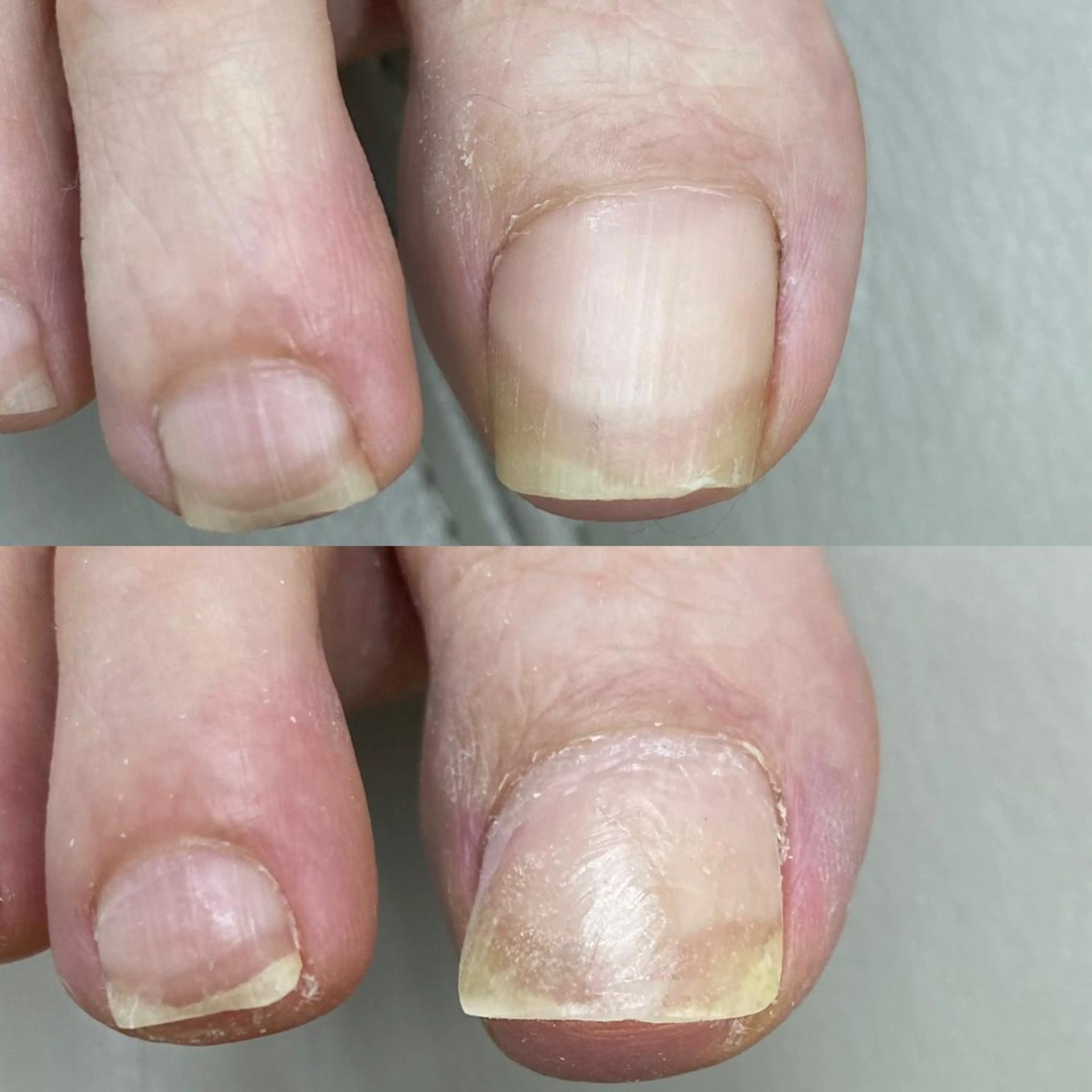 爪の病院屋さん所属・黒田 恵美のその他イメージ