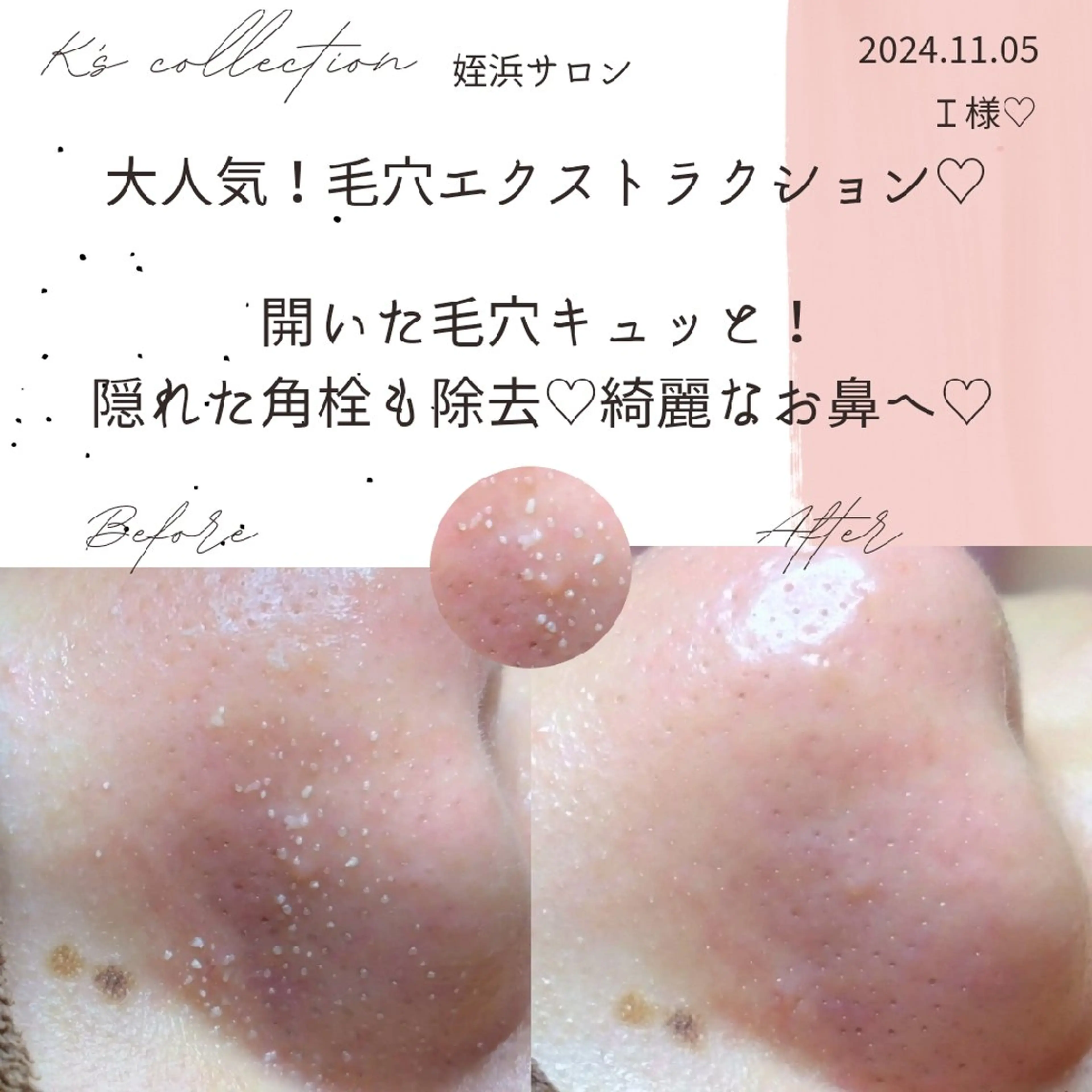 K's姪浜エステ💆 サロン:MAIKOのエステ・リラクイメージ