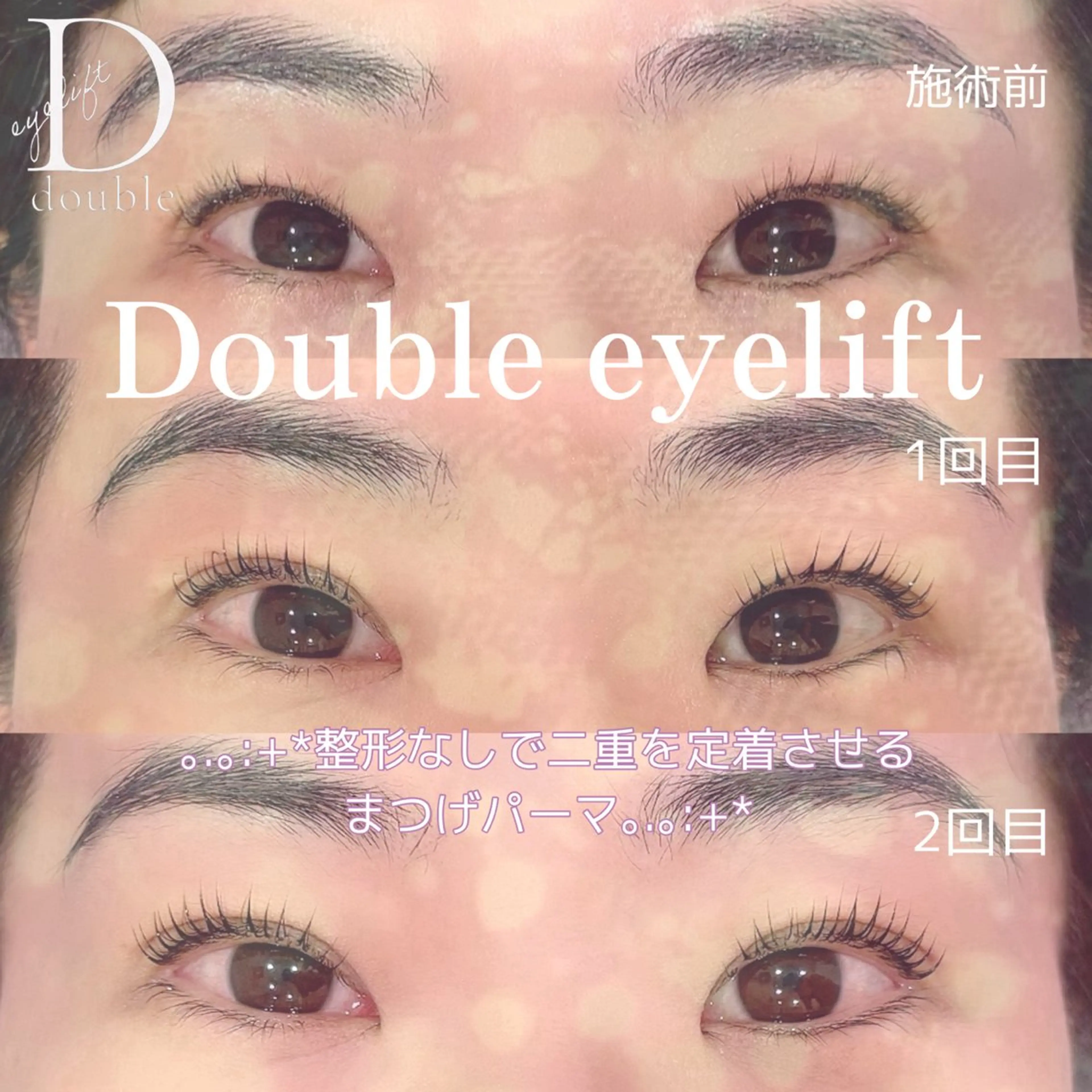 マツエク・マツパ まつげパーマ 🩵ANELA東口 齋藤琴音💚のマツエク・マツパデザイン