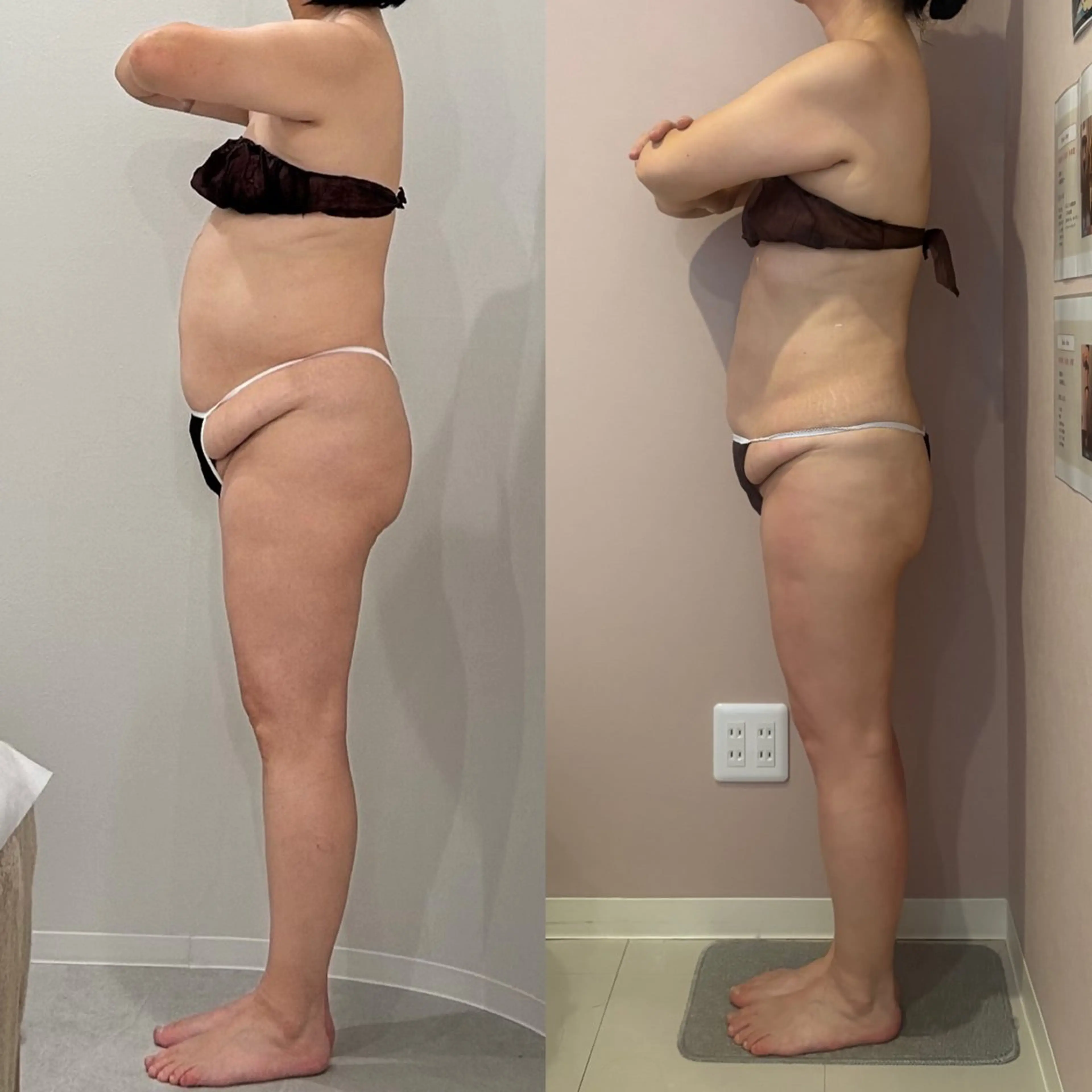 下半身スッキリ・骨盤調整 骨膜リリース　むくみ・下半身太り・ぽっこりお腹にアプローチ！の写真