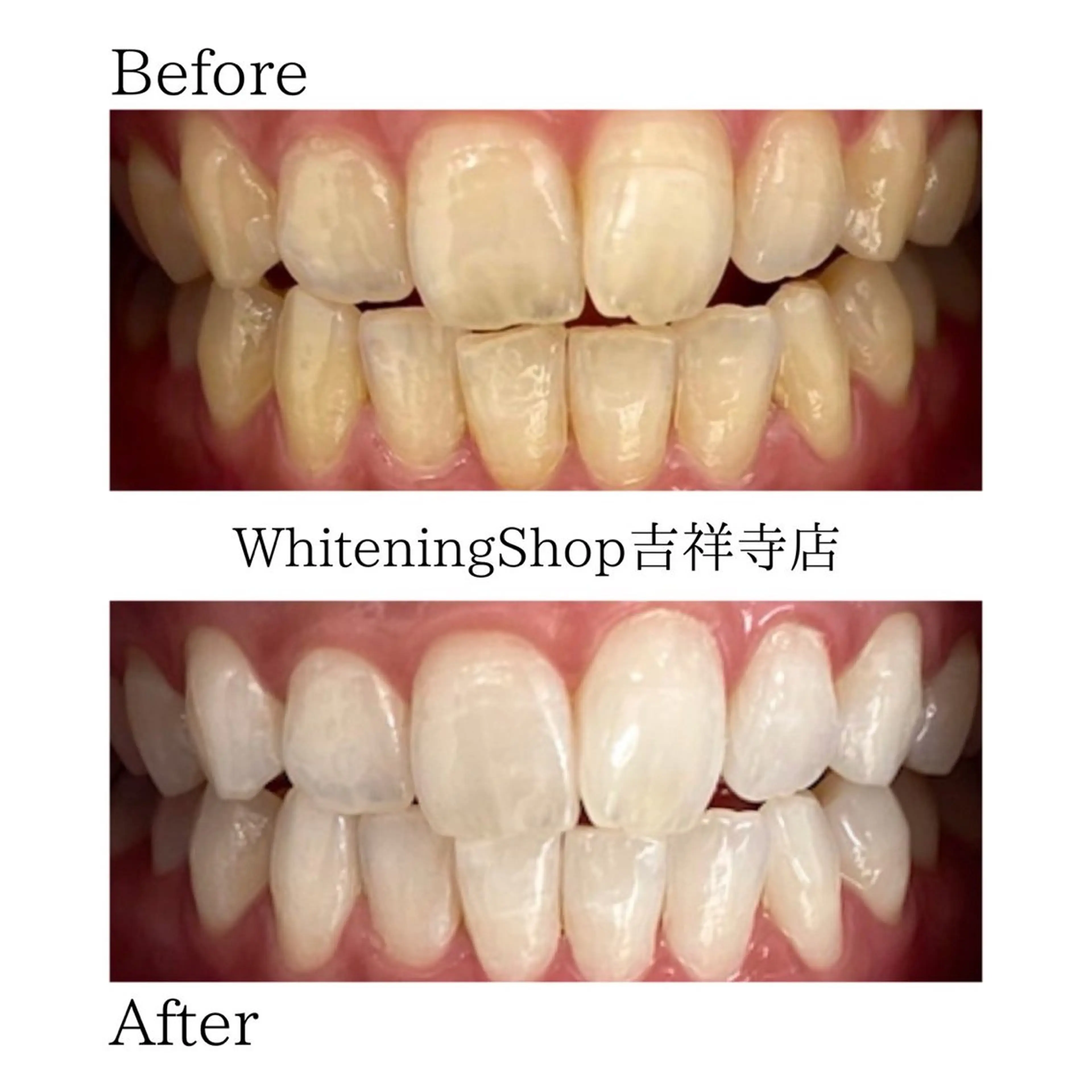 エステ リラク ホワイトニング ショップ吉祥寺店のエステ・リラクイメージ