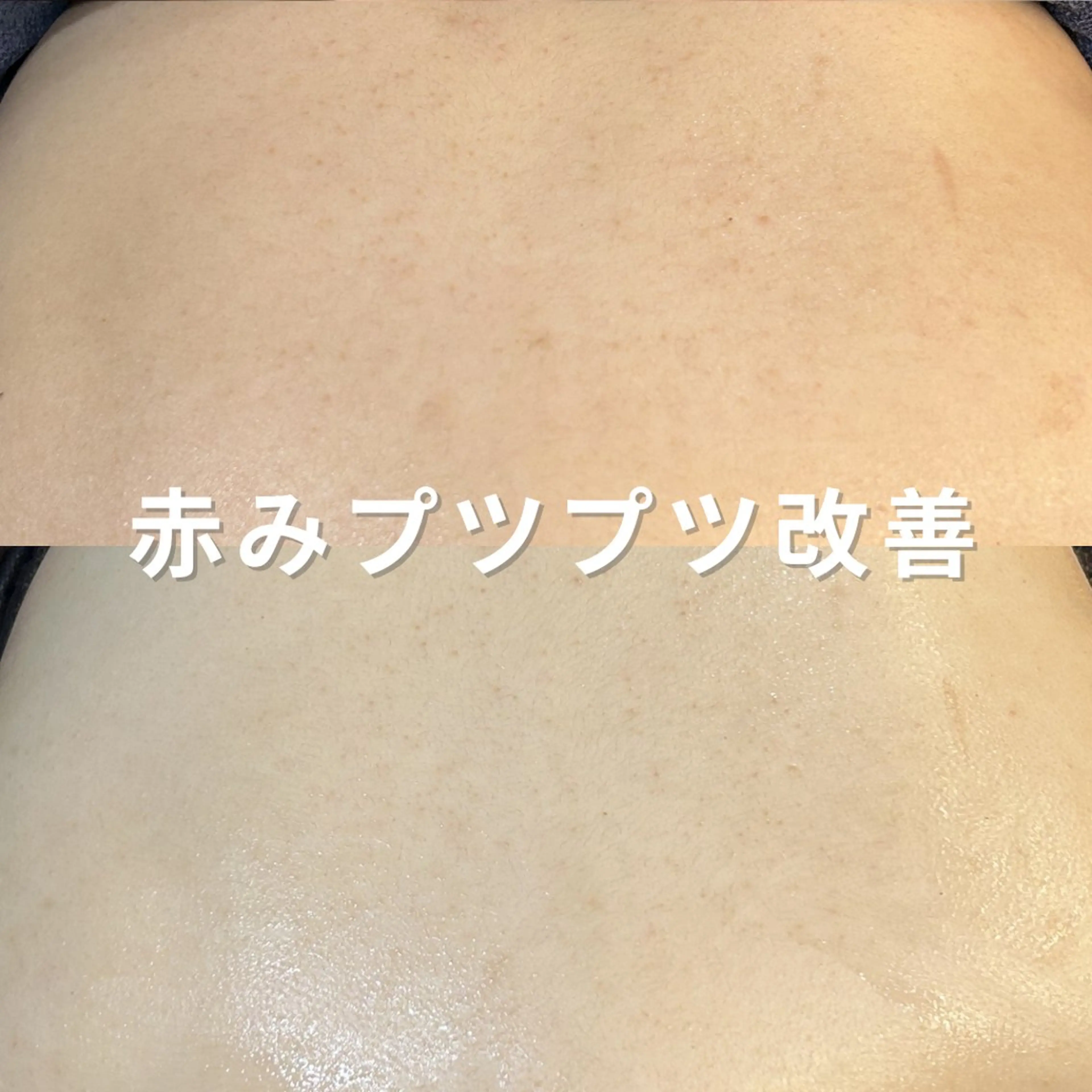 エステ leolo武蔵浦和 肌質改善＆脱毛のエステ・リラクイメージ