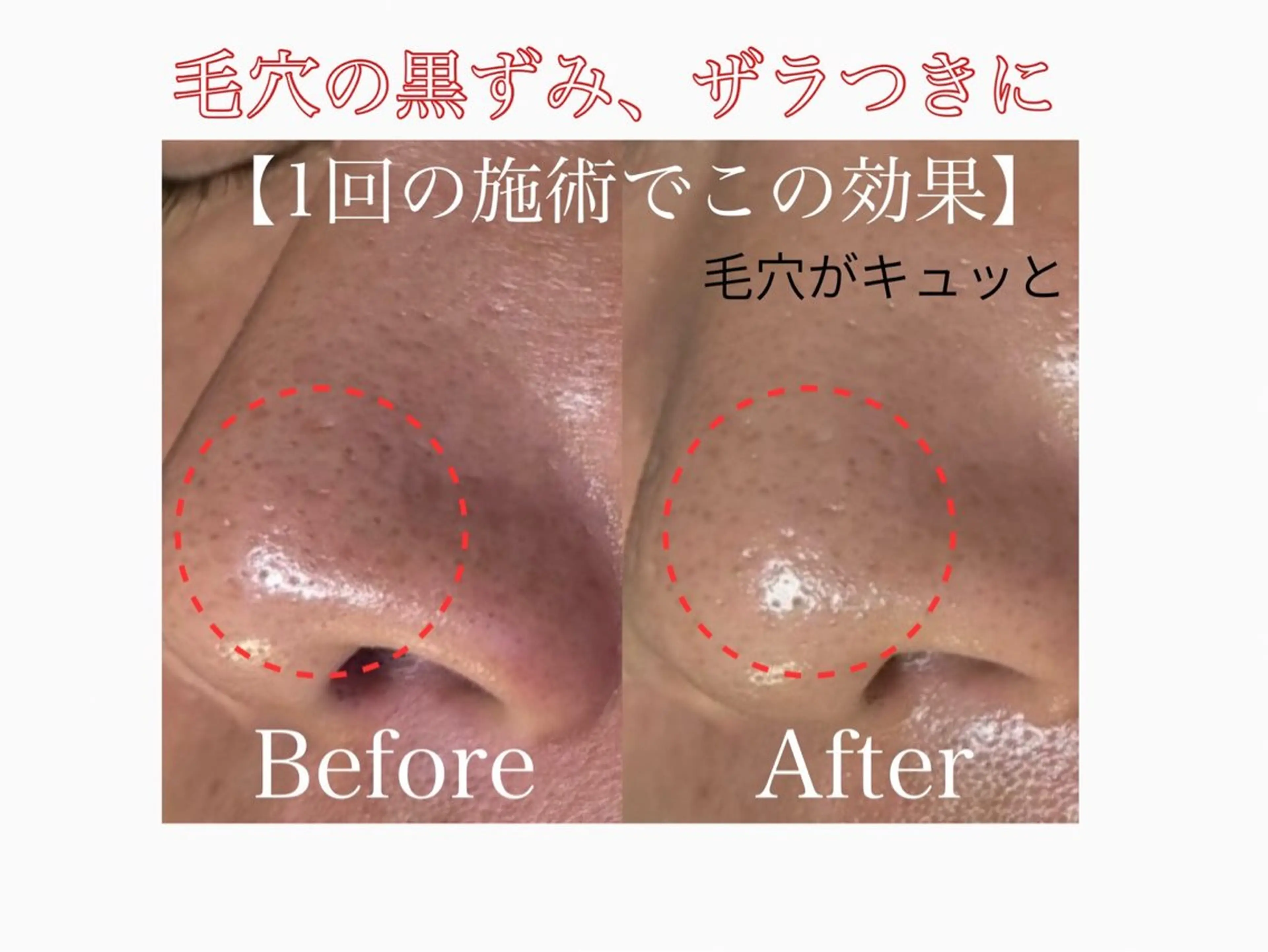 エステ 六本木脱毛andS 店長Sachiのエステ・リラクイメージ