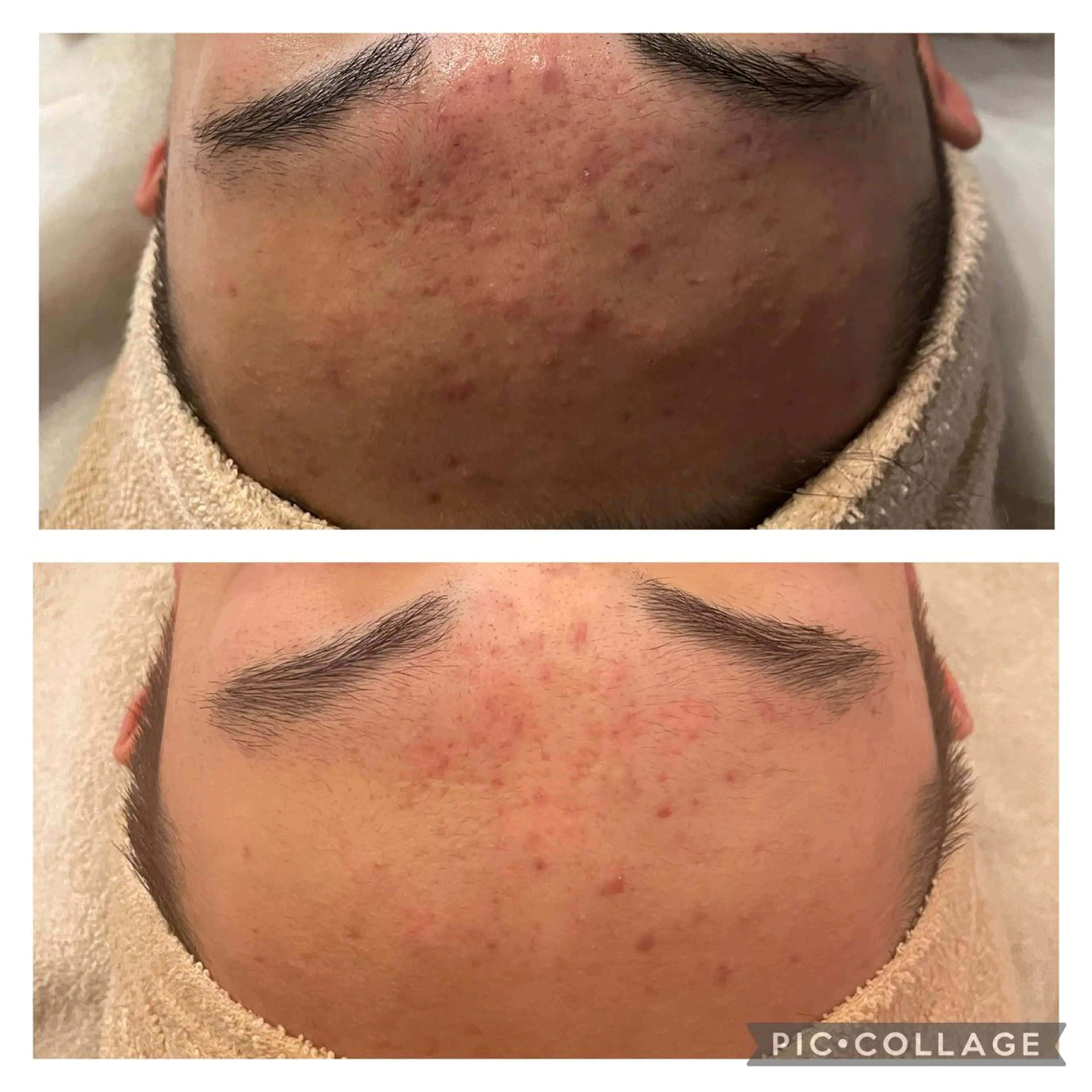 エステ ニキビ改善専門店 d'Albaのエステ・リラクイメージ