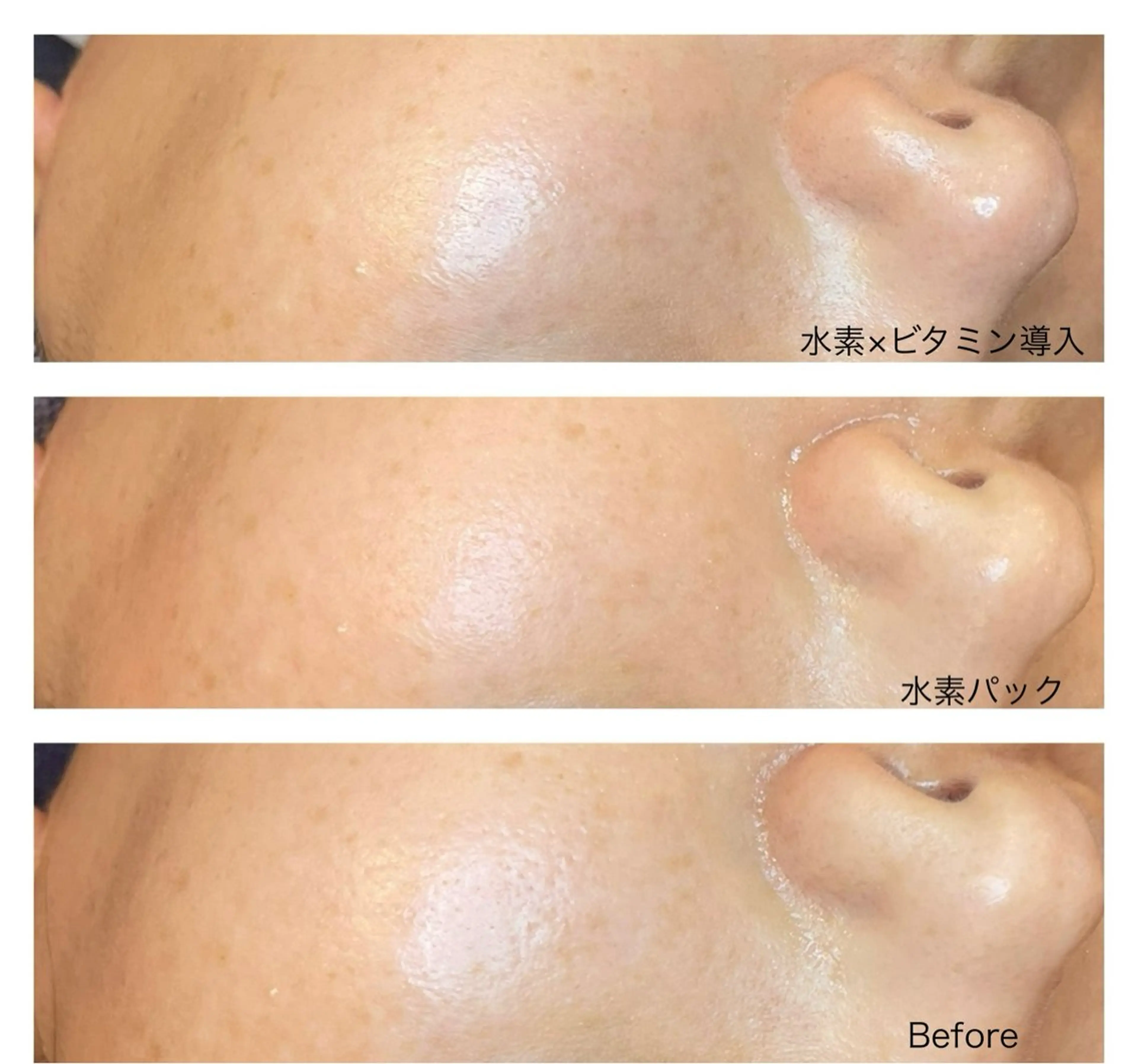 エステ moe beauty salon所属・moe sayuriのエステ・リラクイメージ