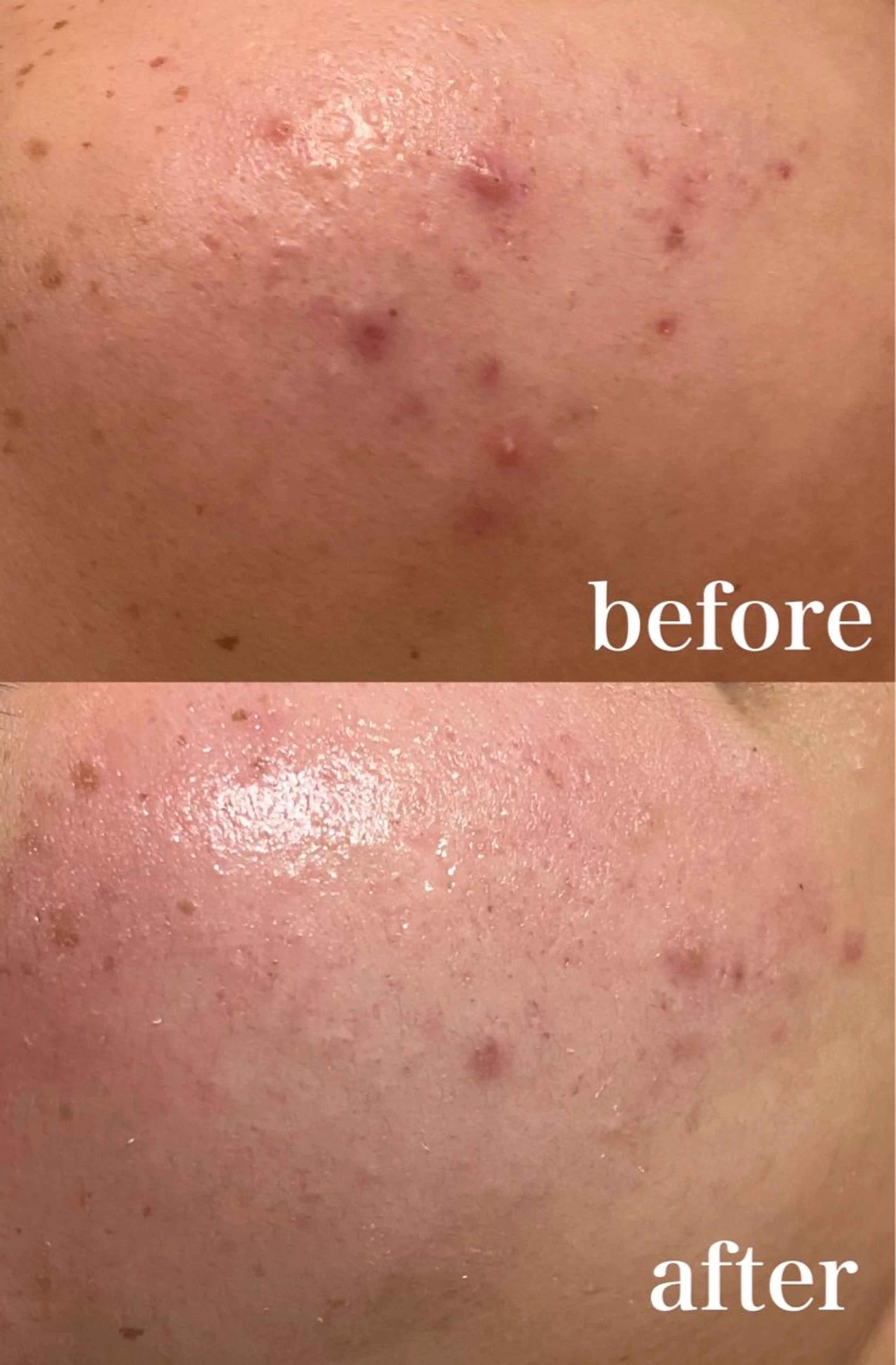 mignon /栄のエステ・リラクイメージ