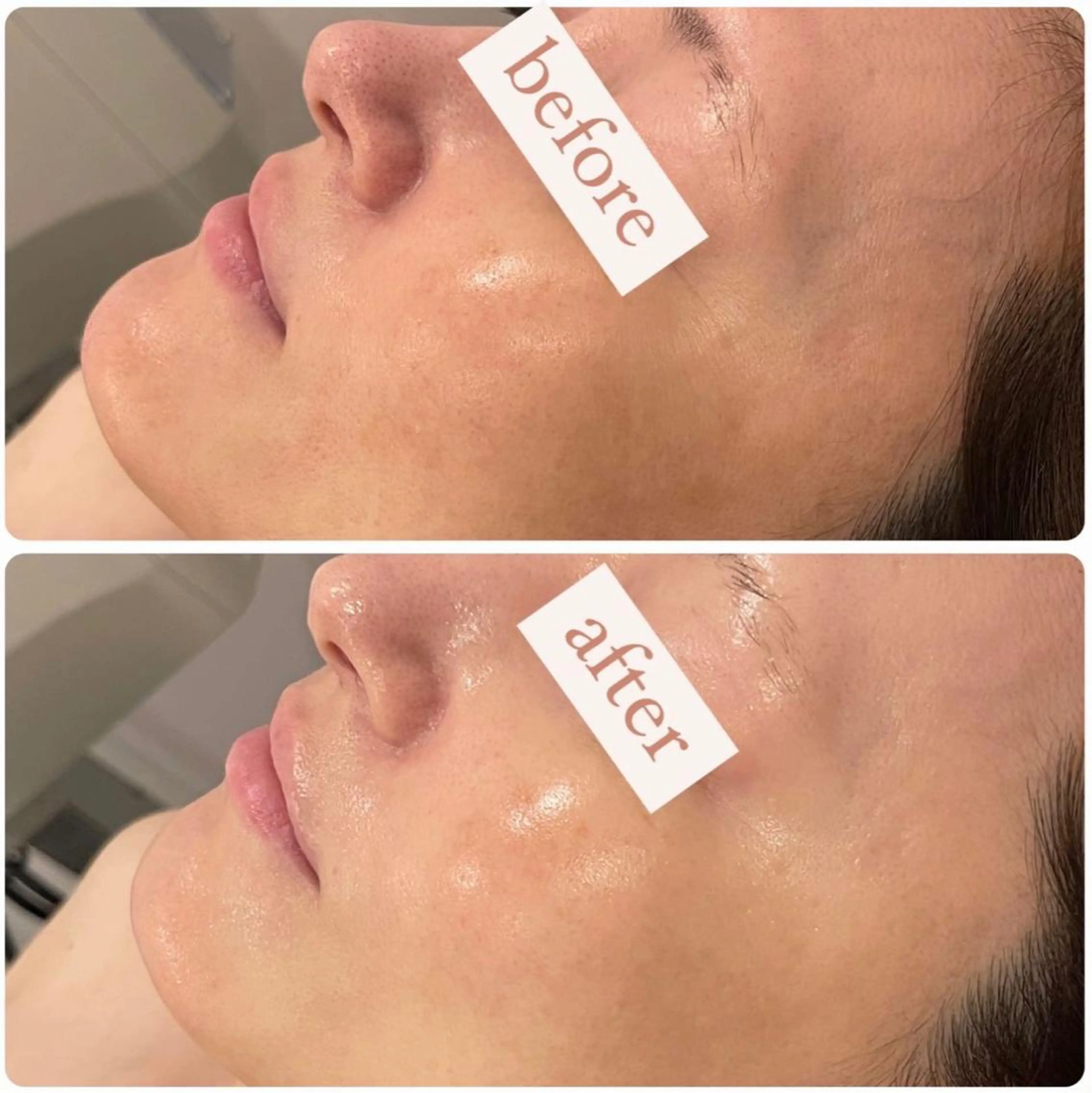 エステ リラク 立体小顔×艶肌×美ボ ディ似合わせ施術 岡のエステ・リラクイメージ