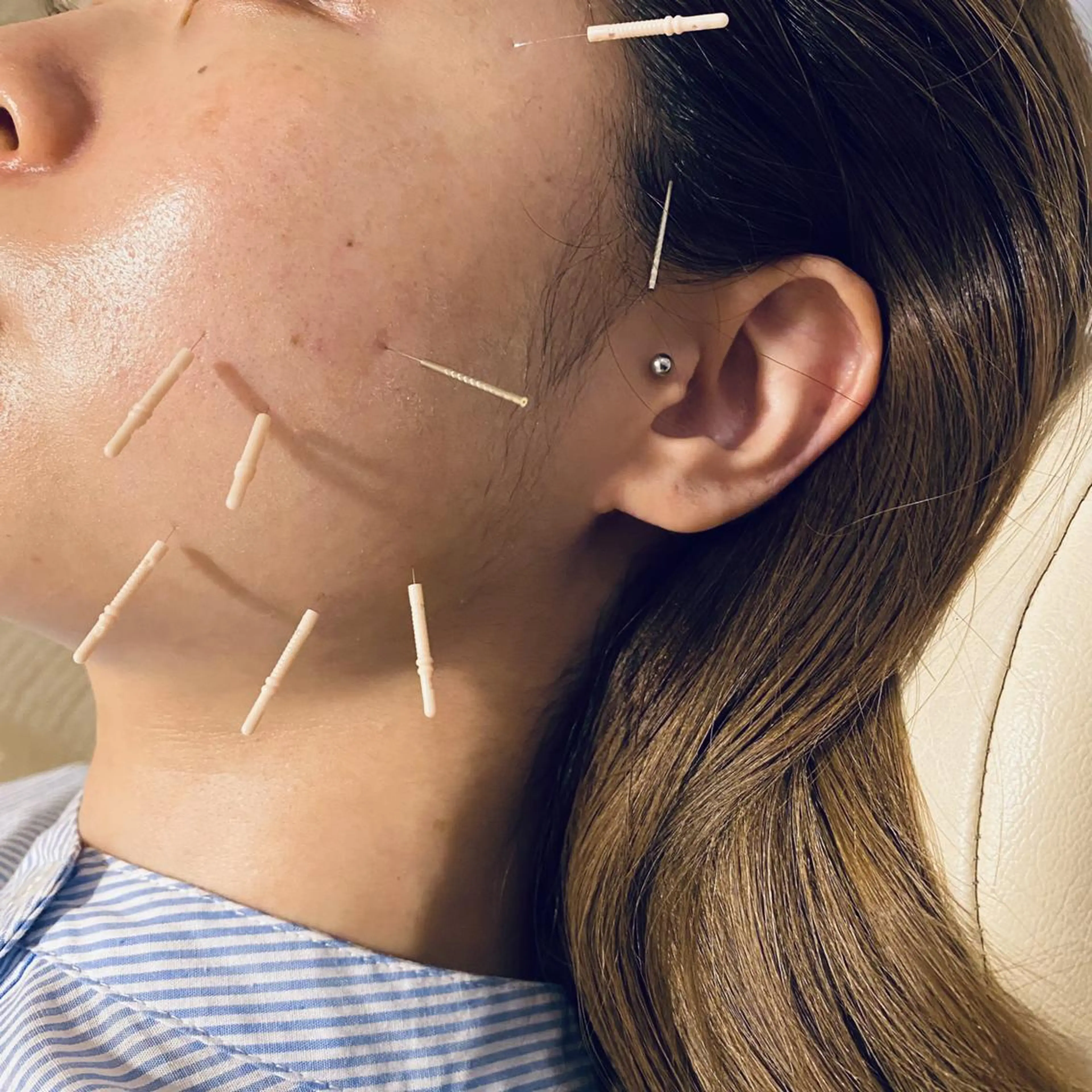 むくみたるみ専門☆ 美容鍼・小顔矯正のエステ・リラクイメージ