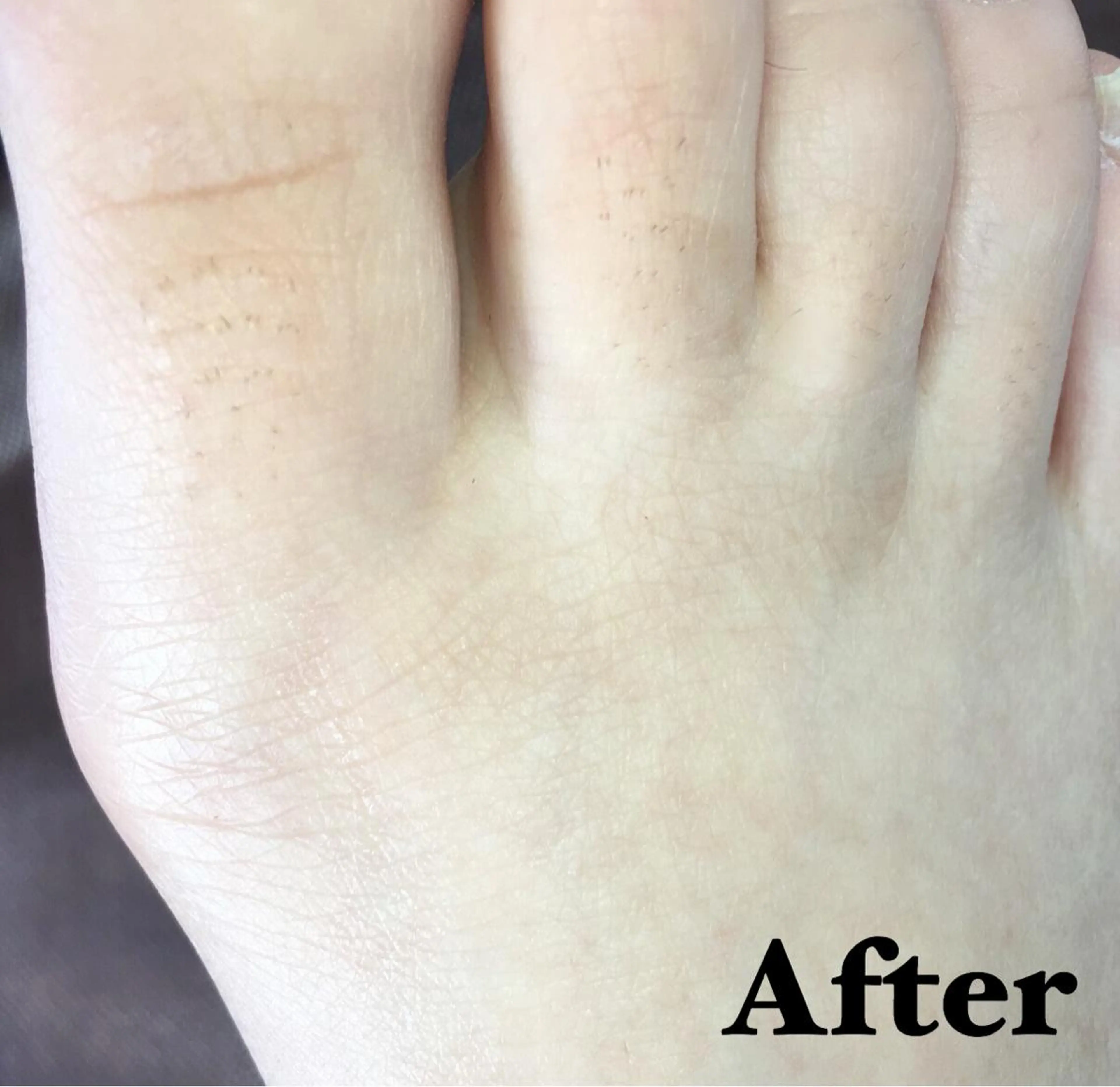 MIMI 吉祥寺本店のエステ・リラクイメージ