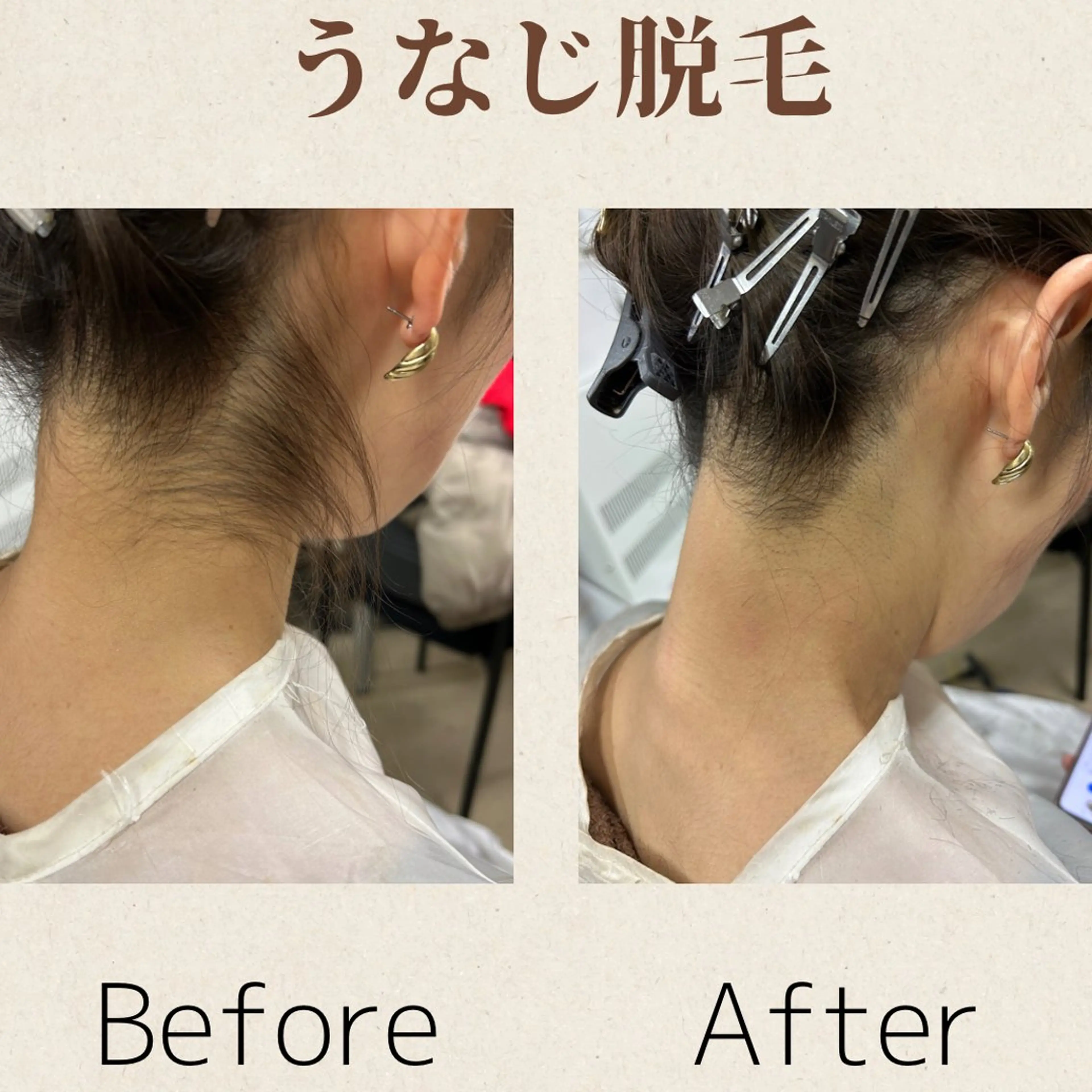 脱毛 MODE K's 白石彩夏のエステ・リラクイメージ