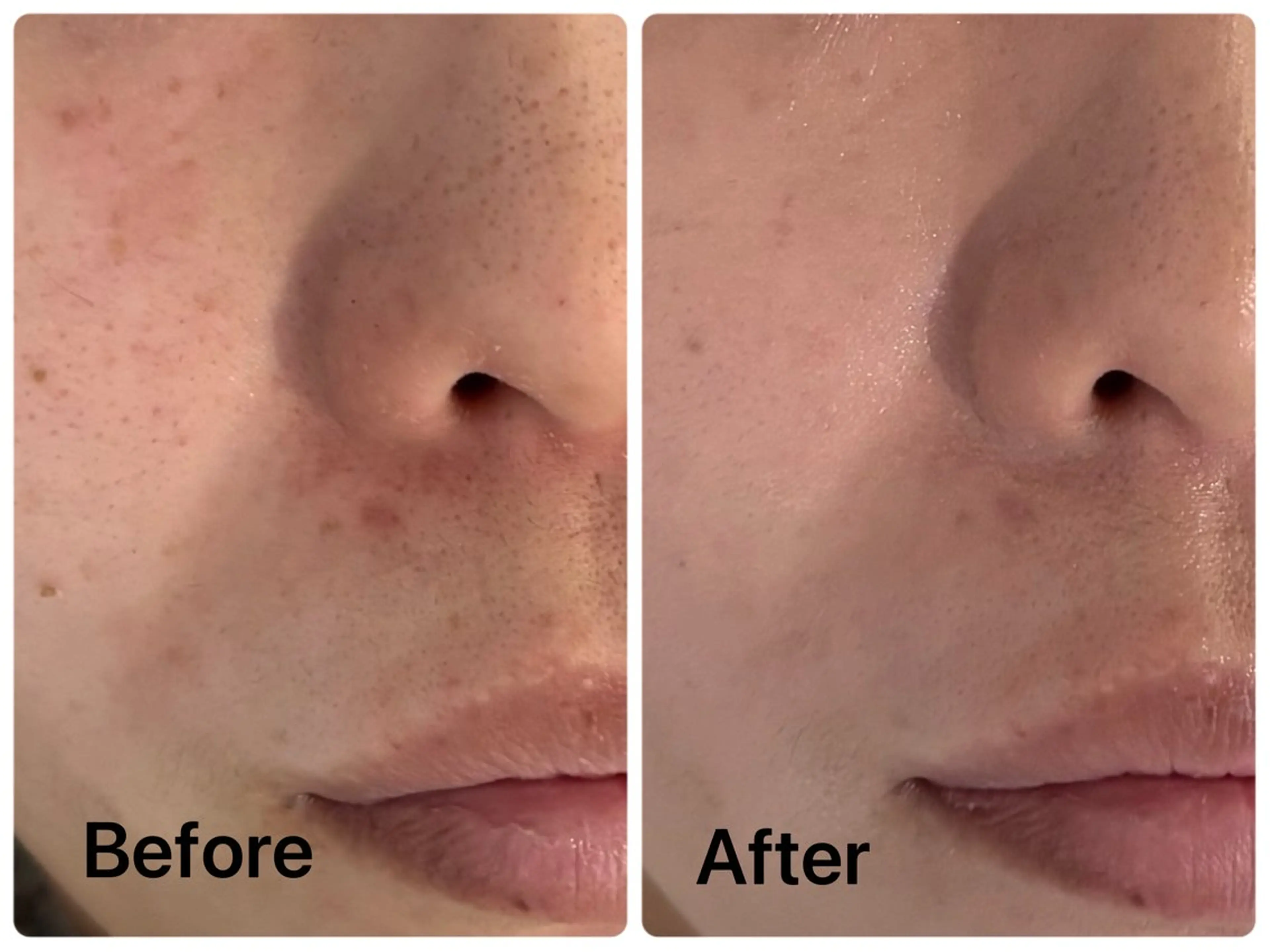 エステ リラク facial salon D 吉沢のエステ・リラクイメージ