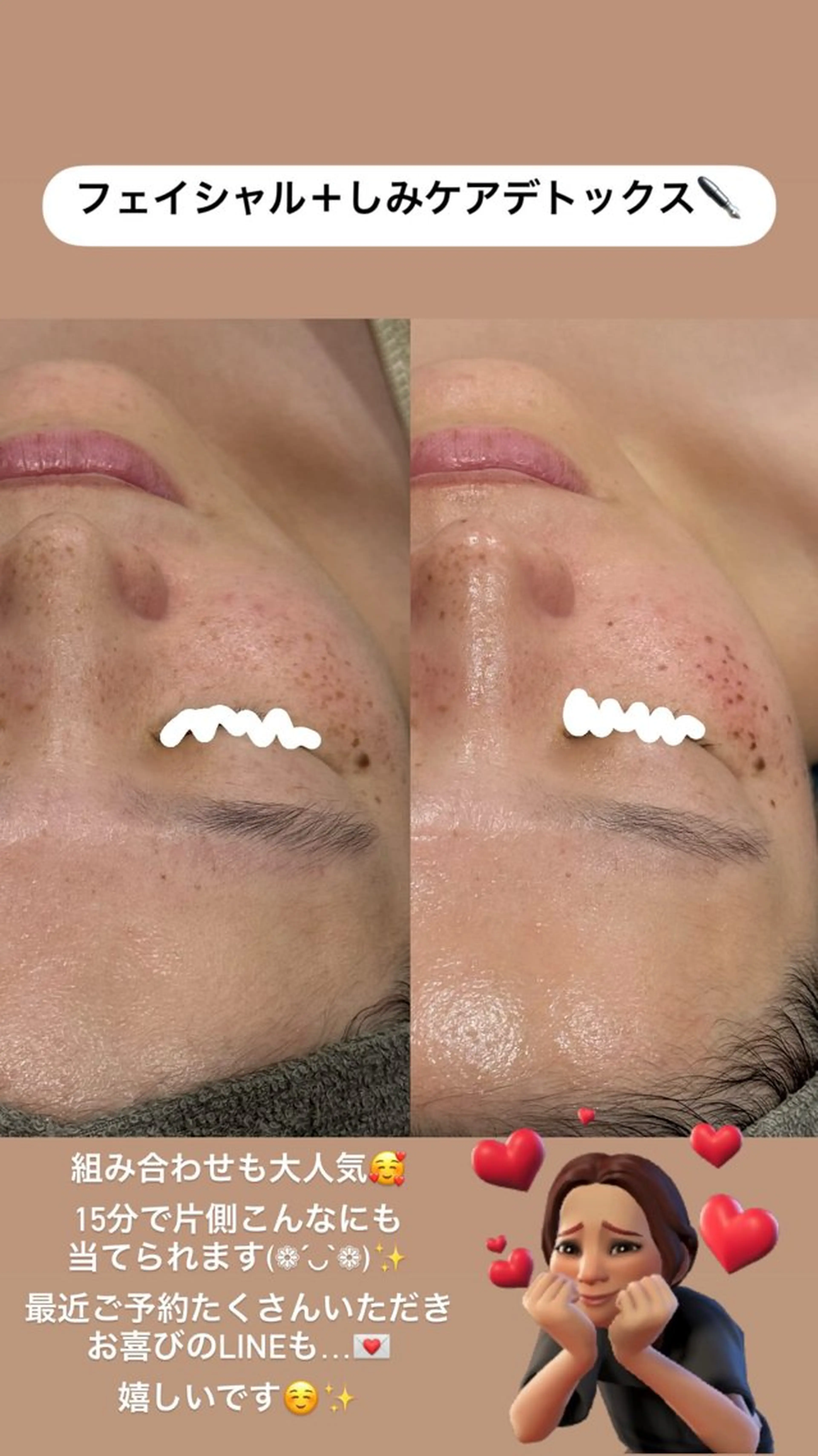 エステ LiZA エステティックサロンのエステ・リラクイメージ