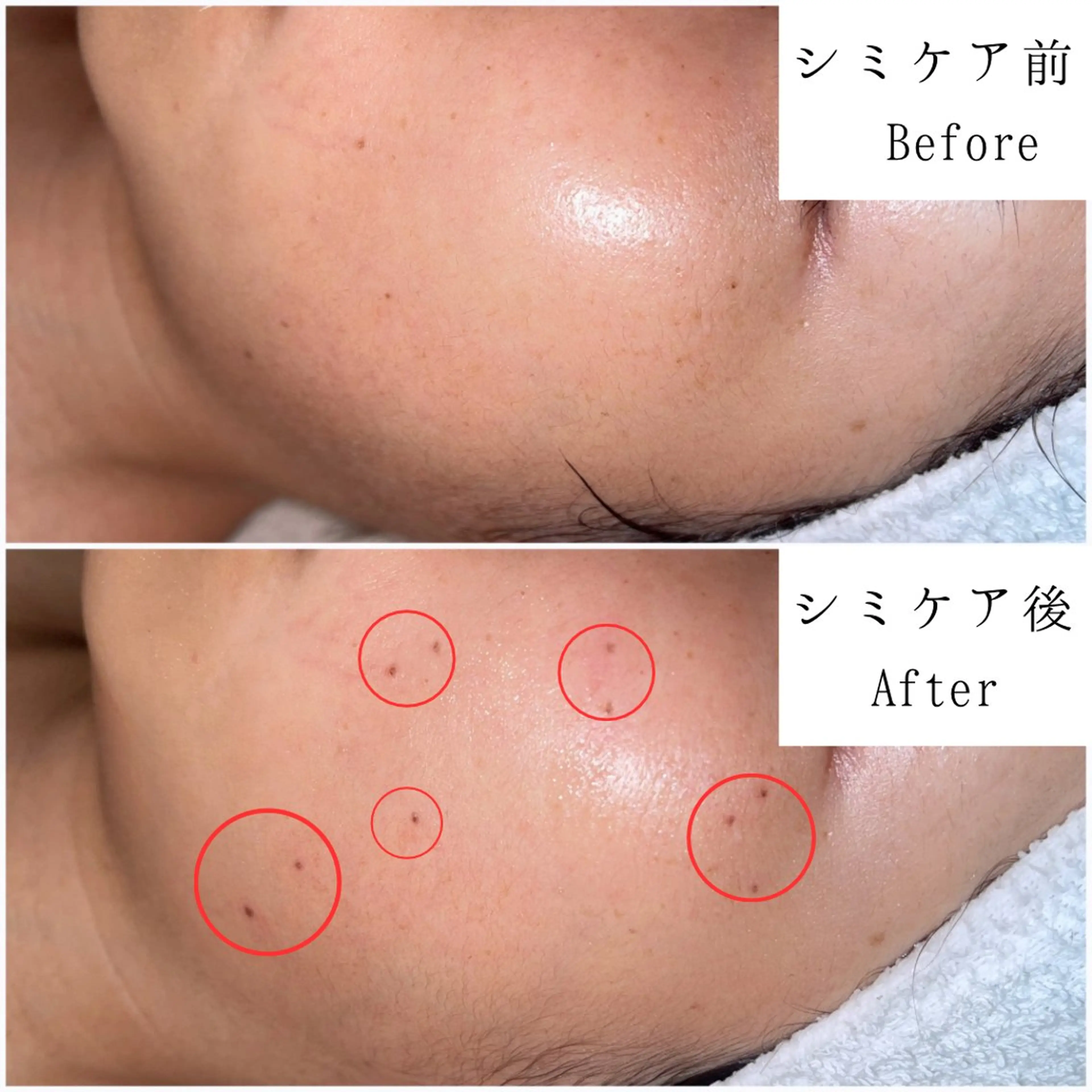 エステ SELF  BEAUTY gracia浦添店所属・gracia 浦添店のその他イメージ