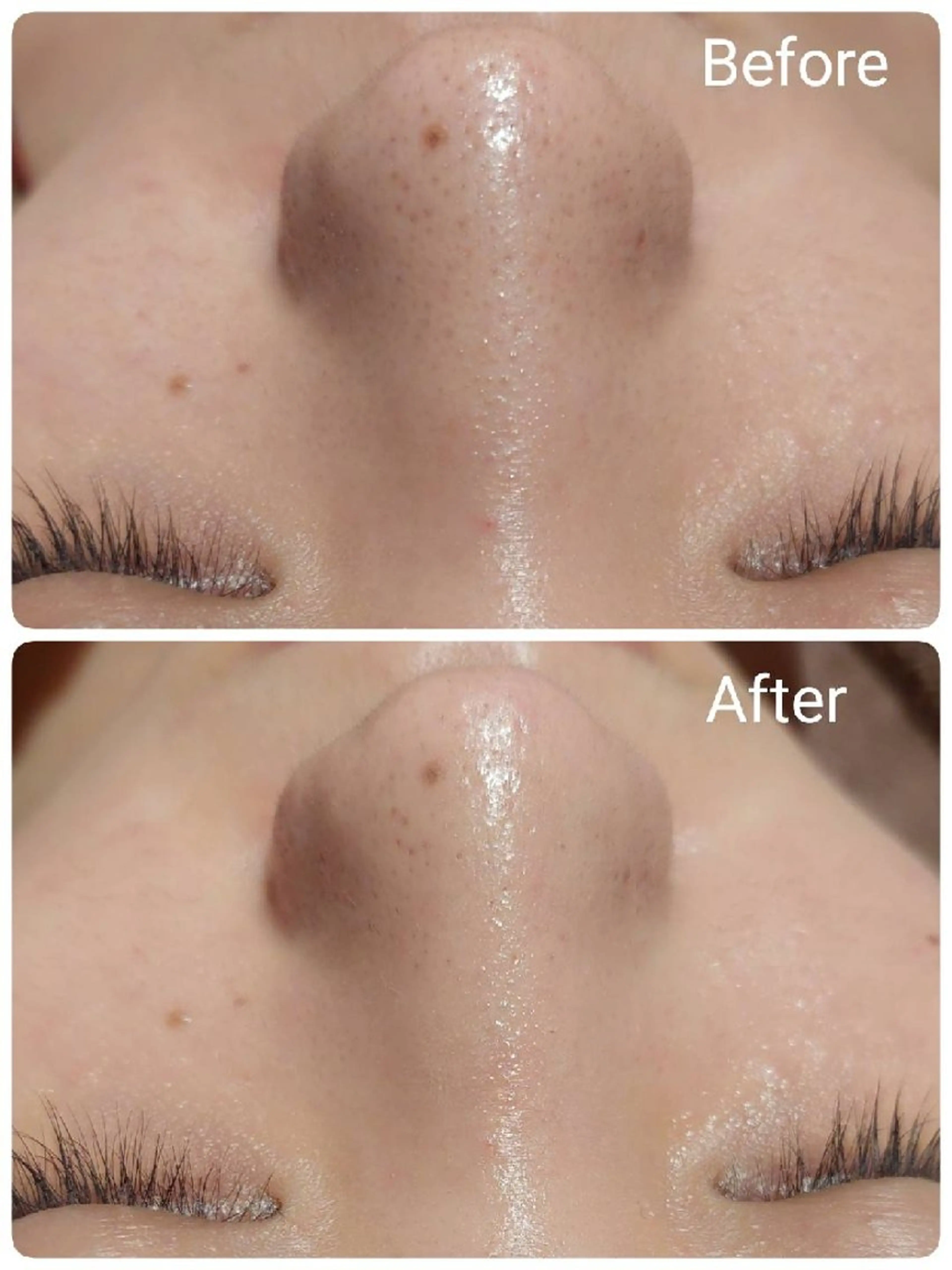 エステ MyFairLady miuのエステ・リラクイメージ