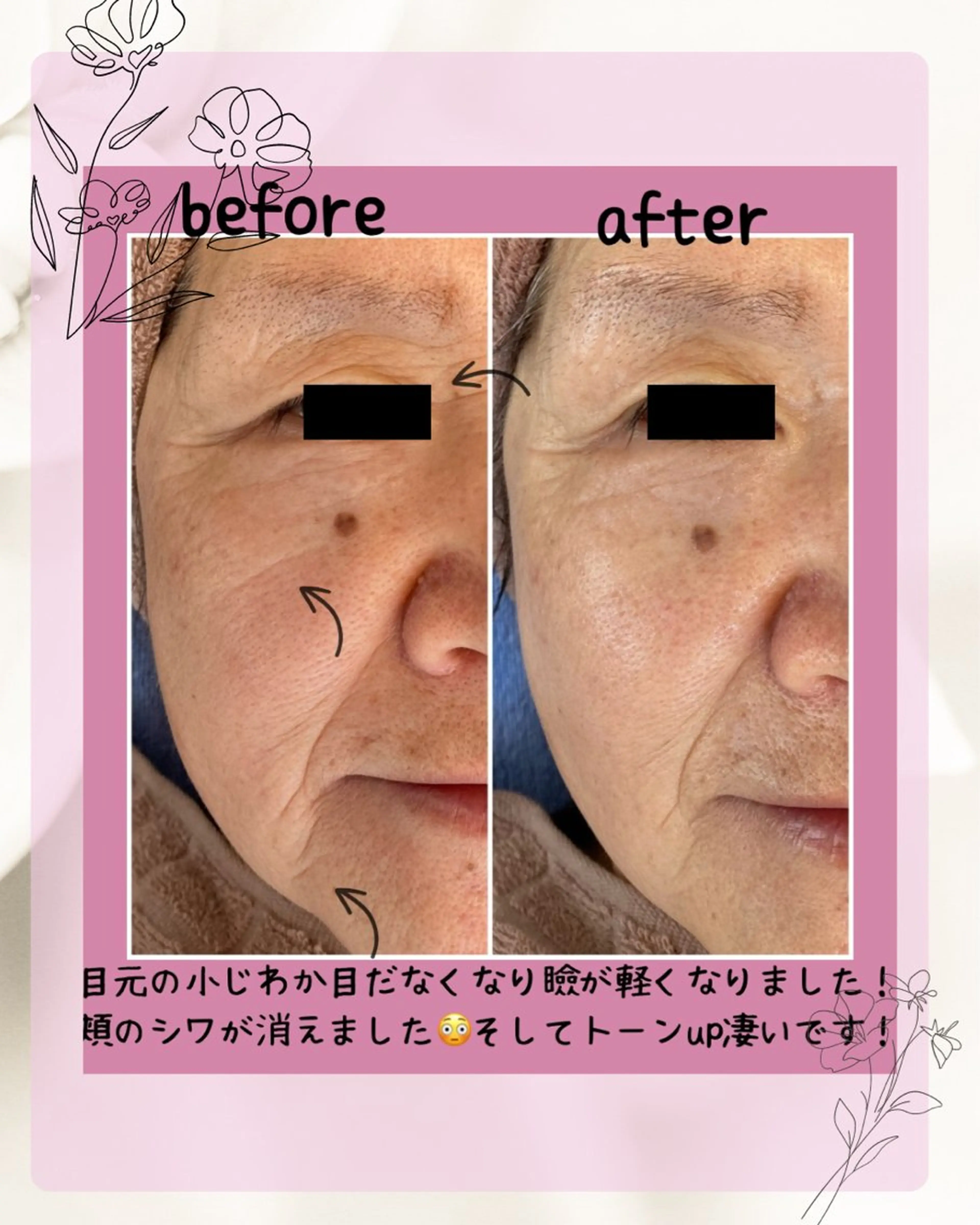 エステ プレジール所属・ビューティサロン プレジールOTAKEのエステ・リラクイメージ