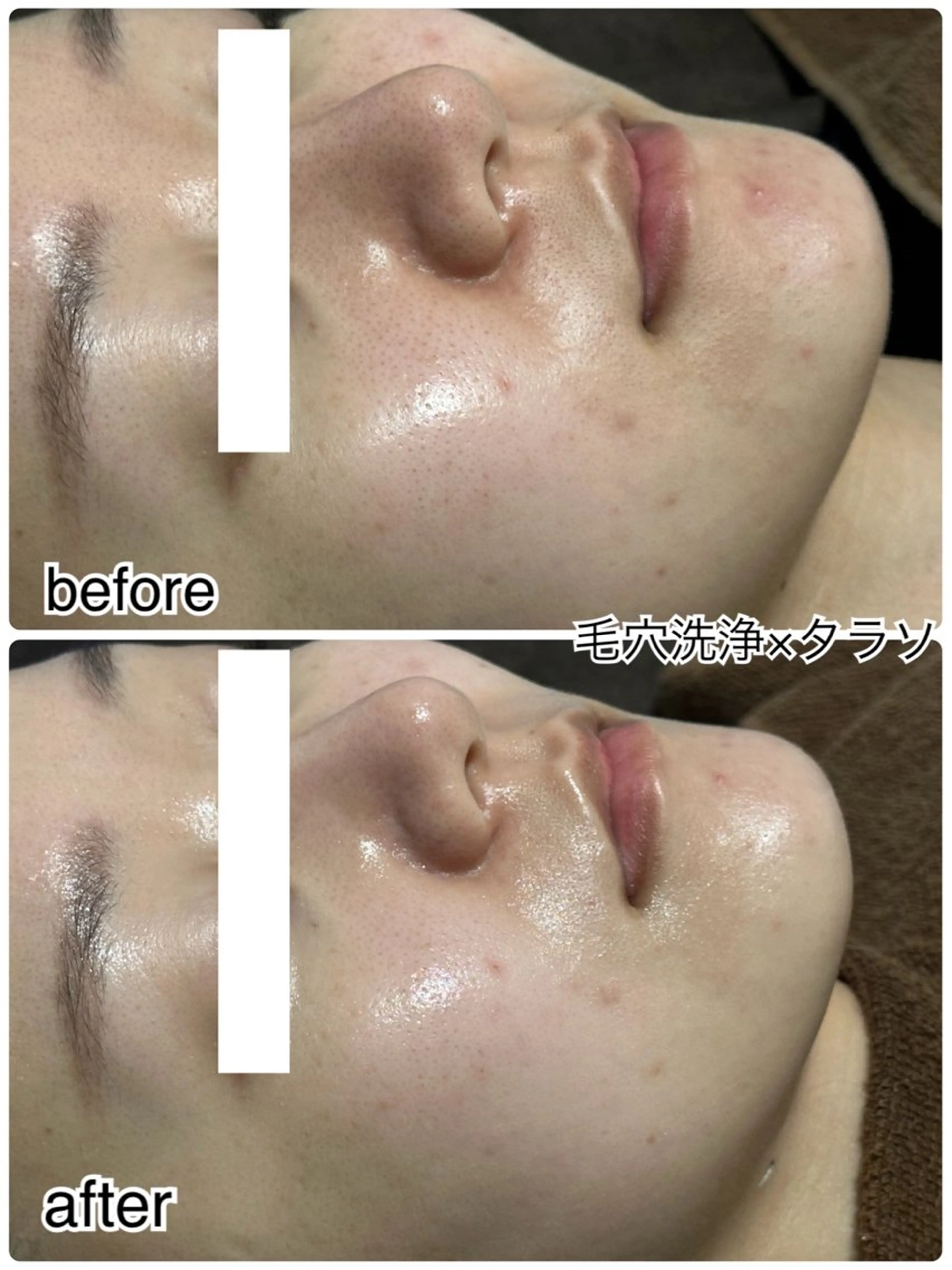 その他 ENCHANT 脱毛.小顔.毛穴のエステ・リラクイメージ