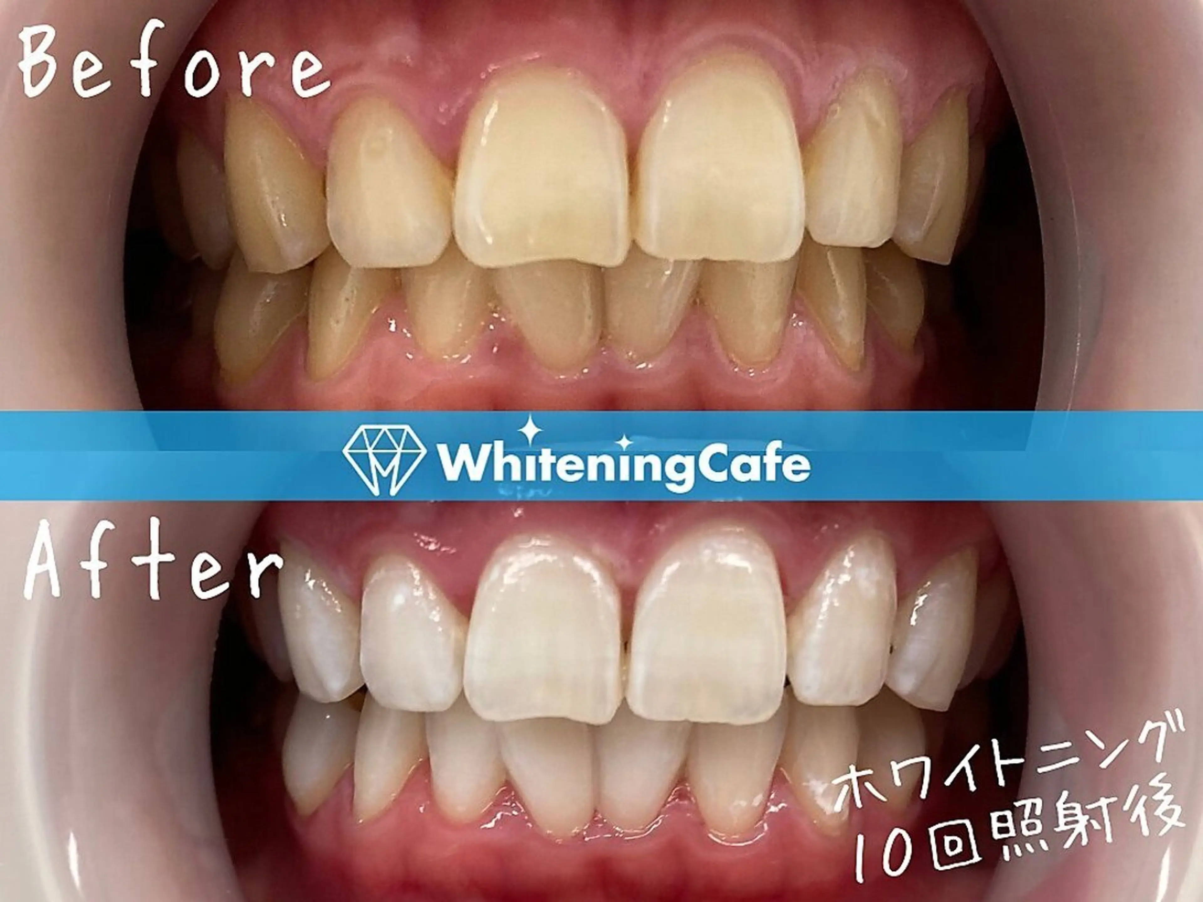 ホワイトニングカフェ中野店所属・ホワイトニングカフェ 中野店のその他イメージ