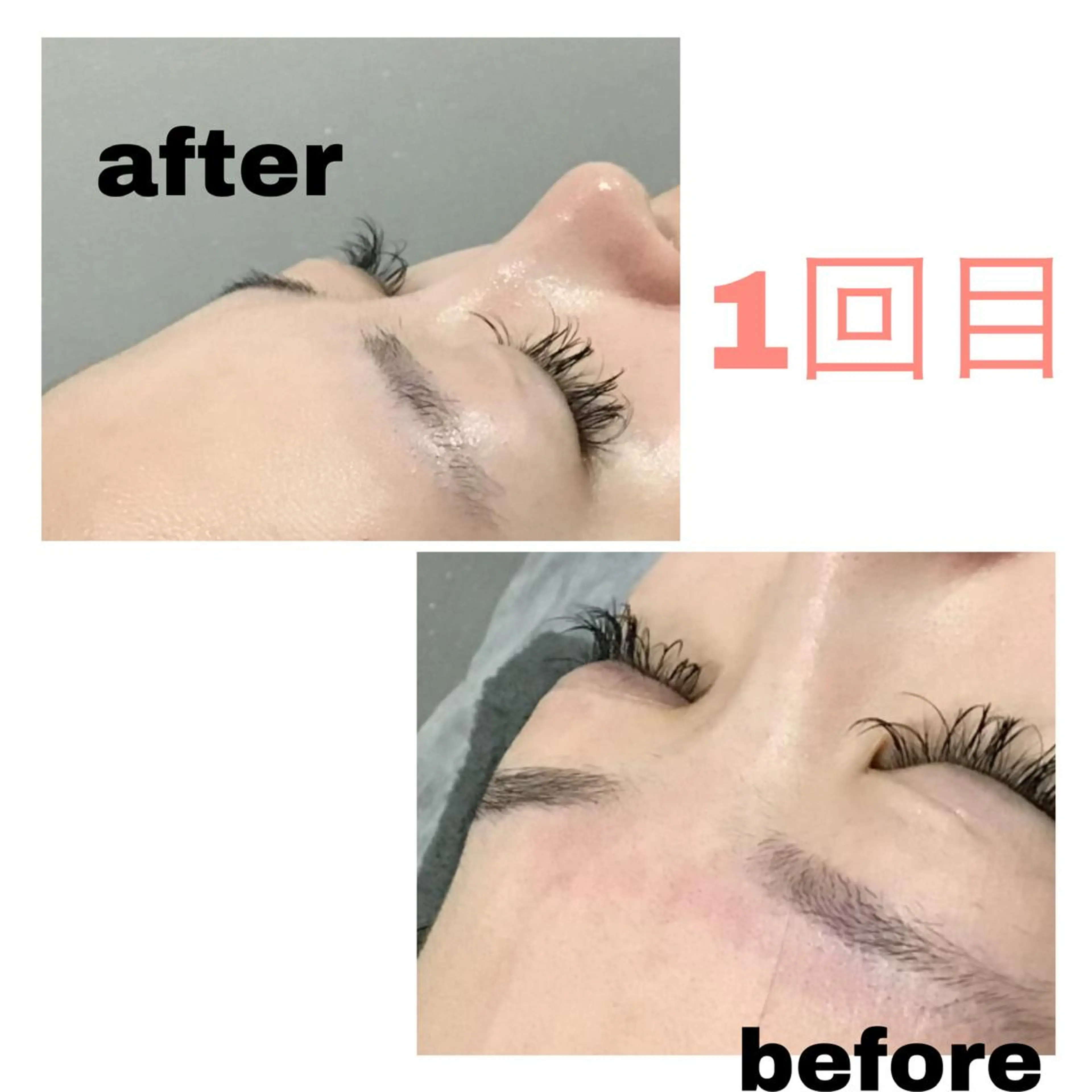 アルカンジュ~archange~所属・痩身/毛穴洗浄/脱毛 アルカンジュのエステ・リラクイメージ