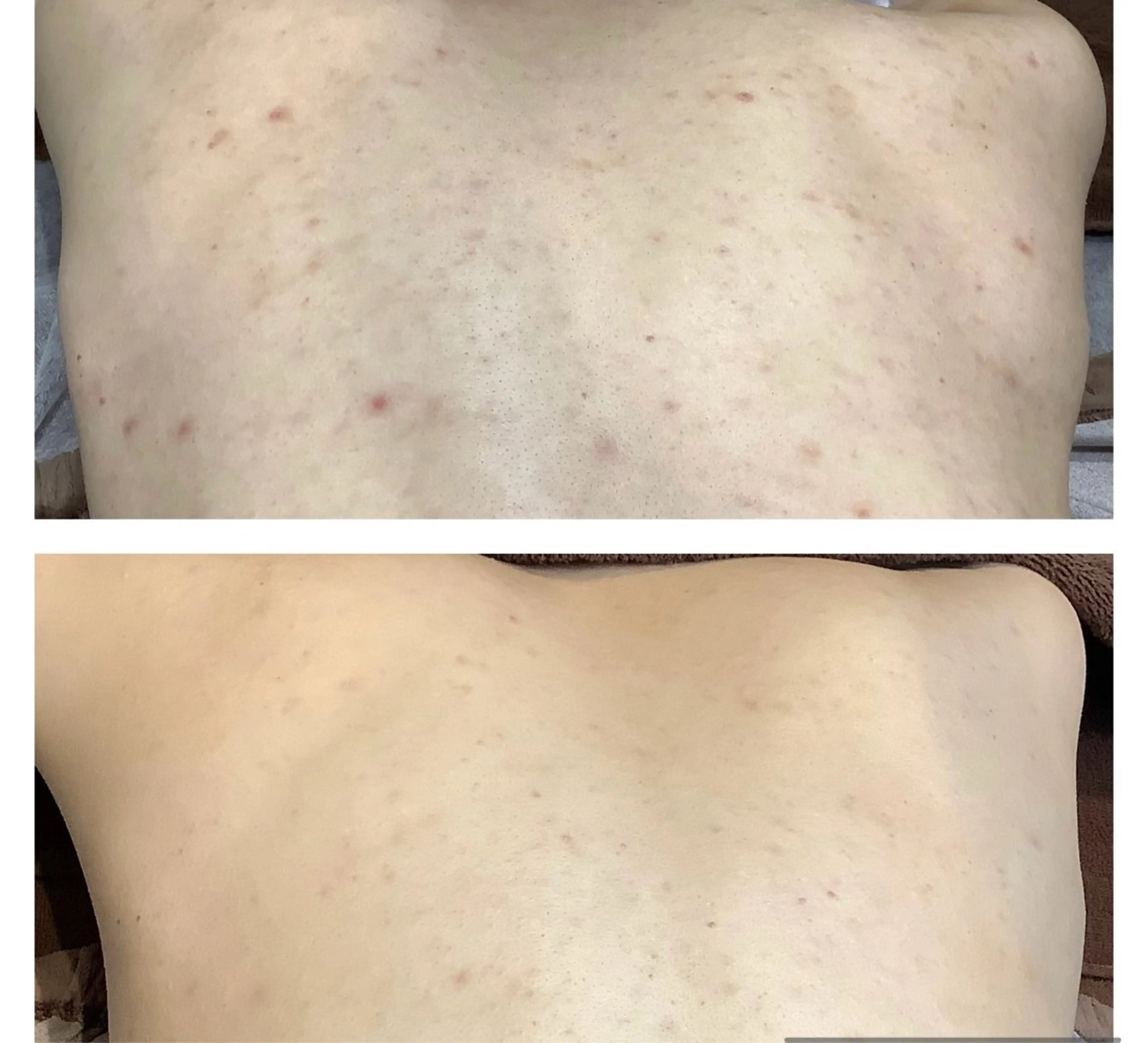 肌質改善◇結果重視 美麗-MIREI-のマツエク・マツパデザイン