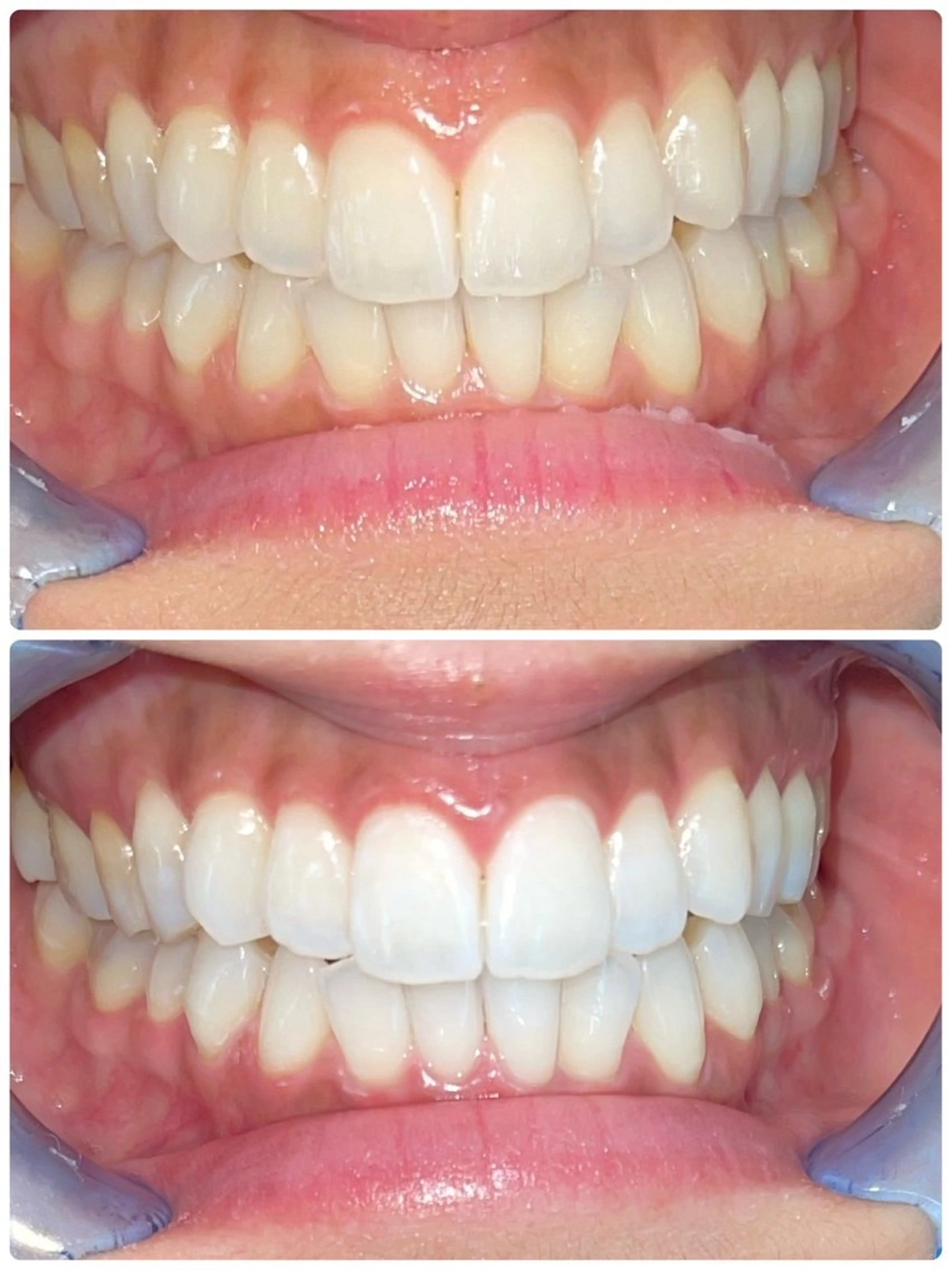 セルフホワイトニング エクシア徳島店マユのその他イメージ